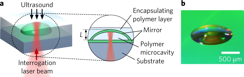 micro focus ultrasound micro focus ultrasound