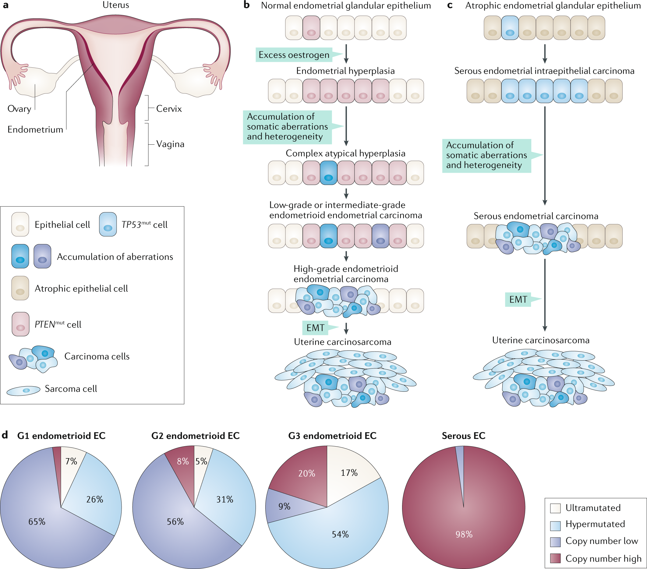 Endometrial adenocarcinoma initially mistaken as urinary incontinence -  ScienceDirect