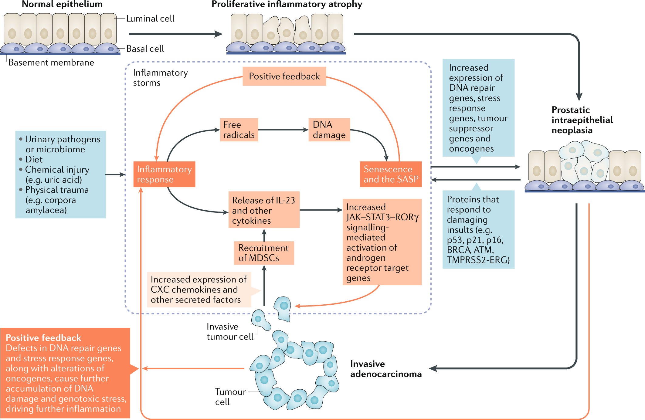 Nature Reviews Cancer - This Review discusses intra-prostatic inflammatory ...