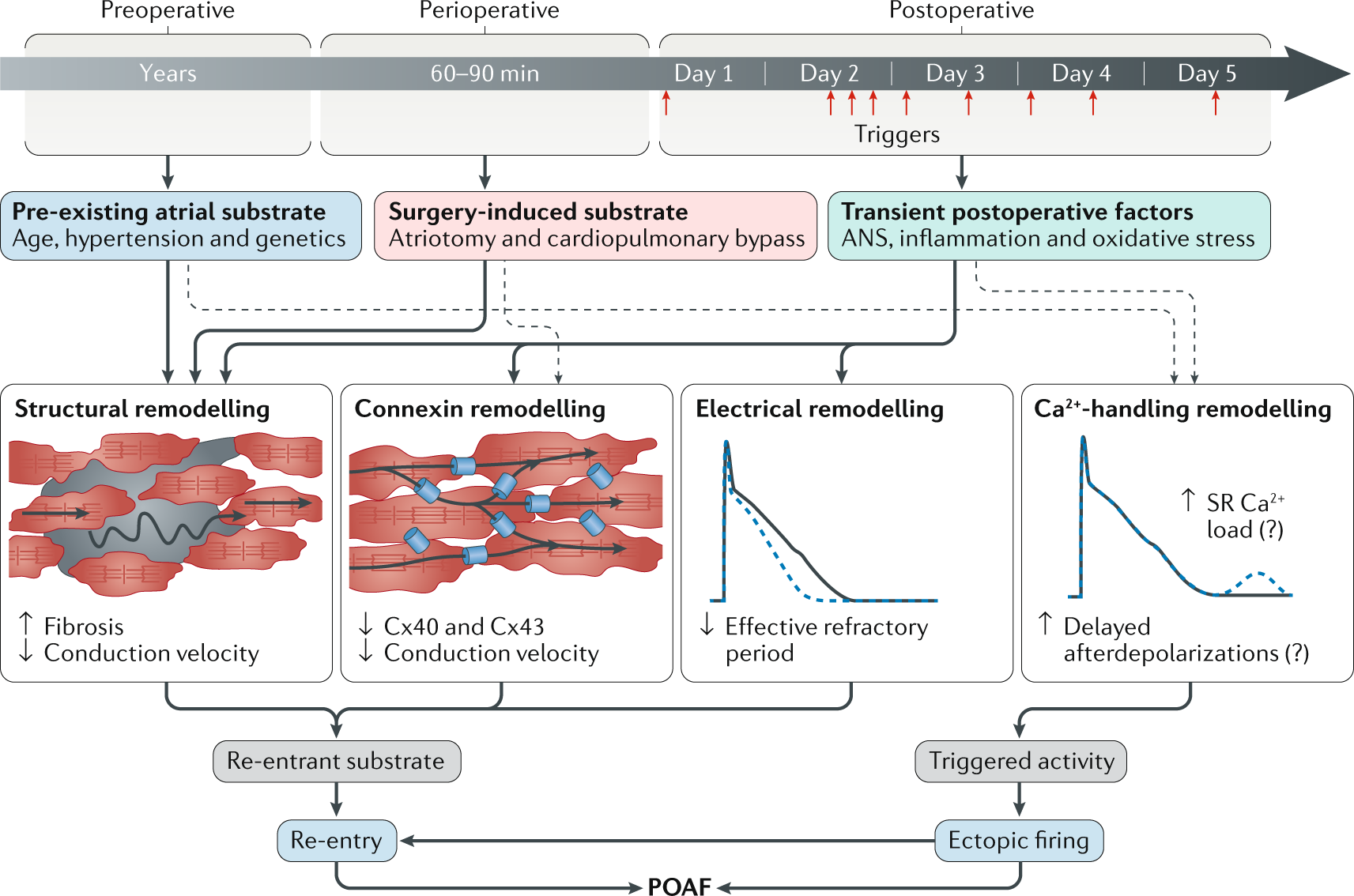 Postoperative Atrial Fibrillation Mechanisms Manifestations And Management Nature Reviews Cardiology
