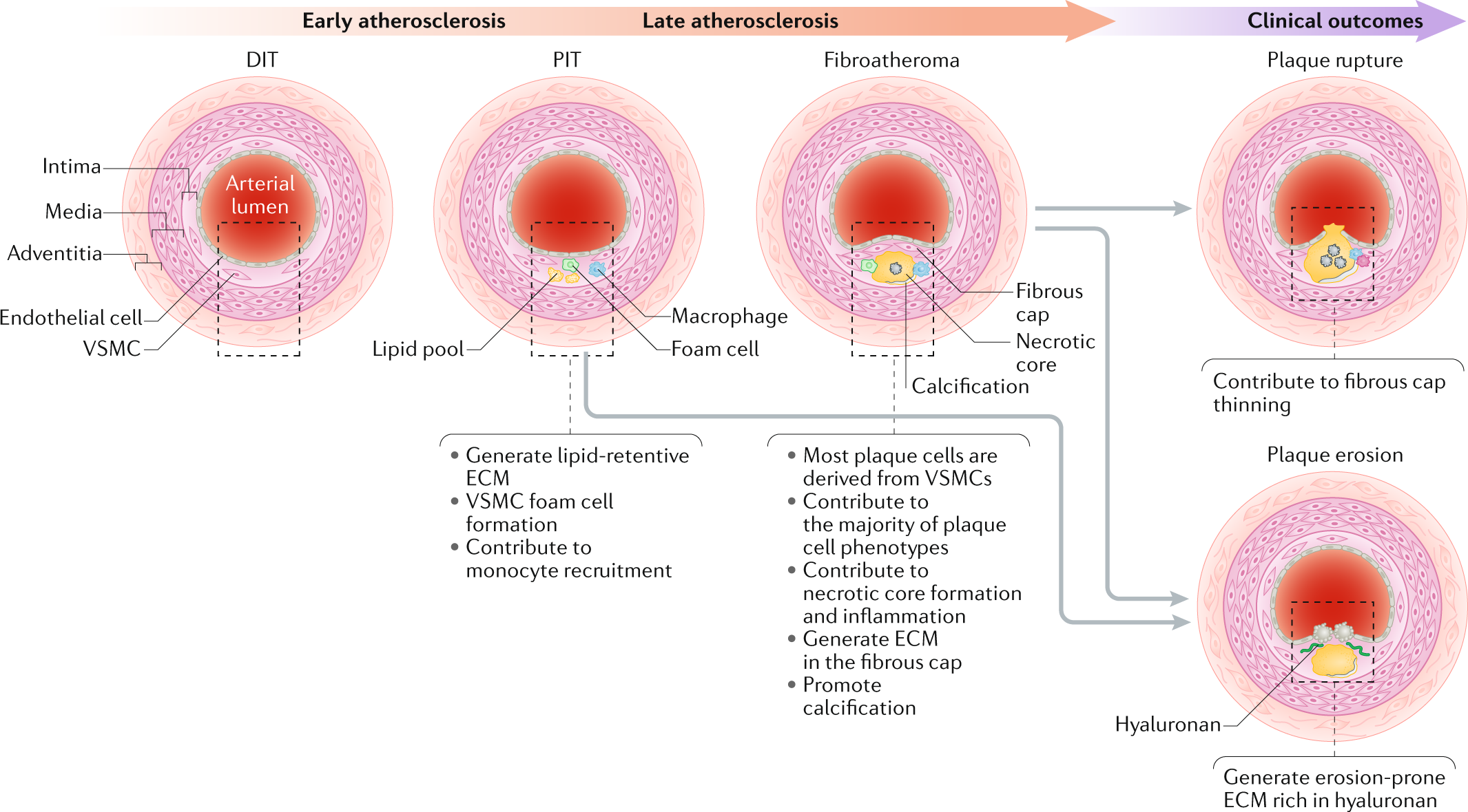 sindsyg sponsor patient Vascular smooth muscle cells in atherosclerosis | Nature Reviews Cardiology