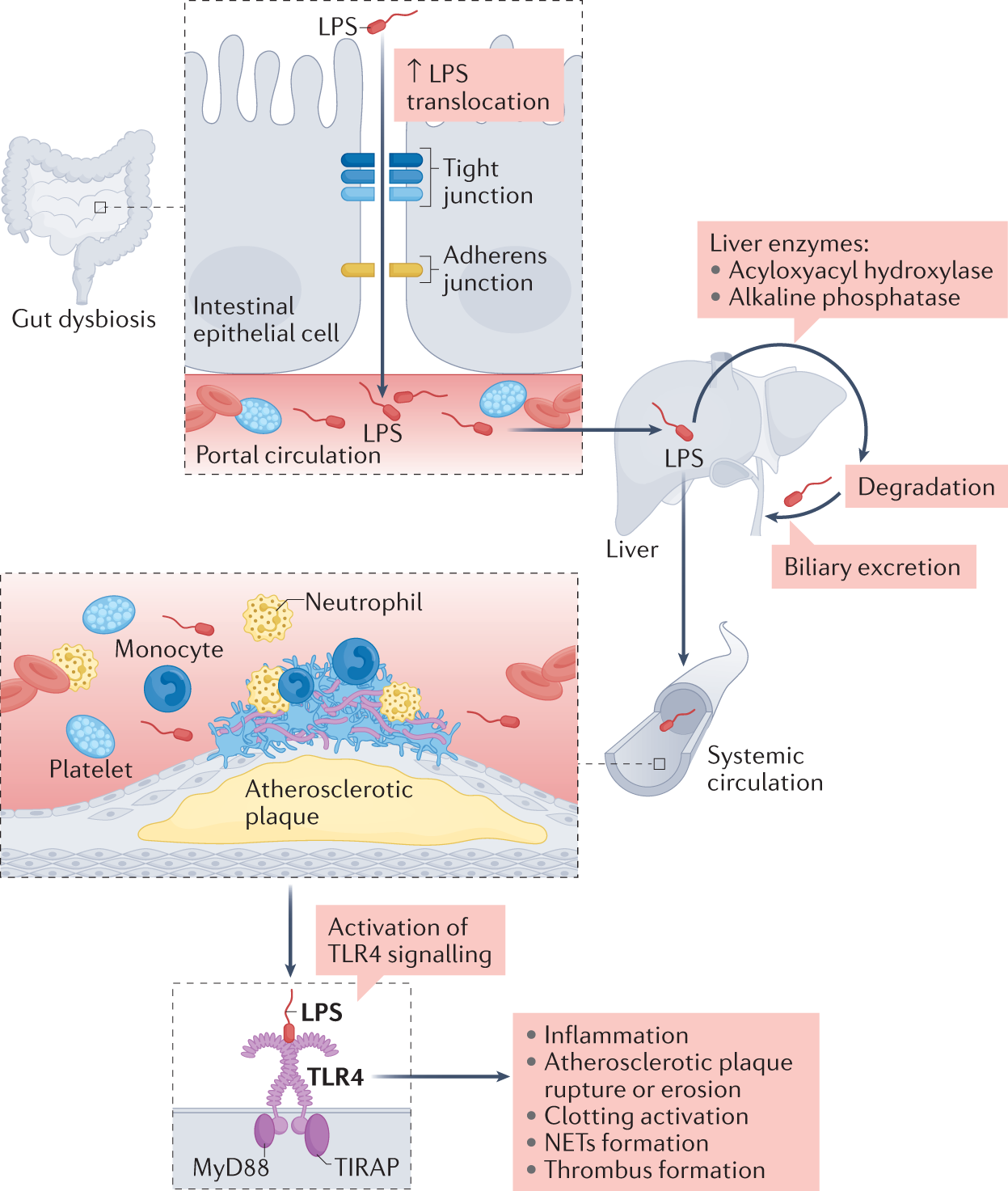 Bryde igennem i går Helligdom Gut-derived low-grade endotoxaemia, atherothrombosis and cardiovascular  disease | Nature Reviews Cardiology