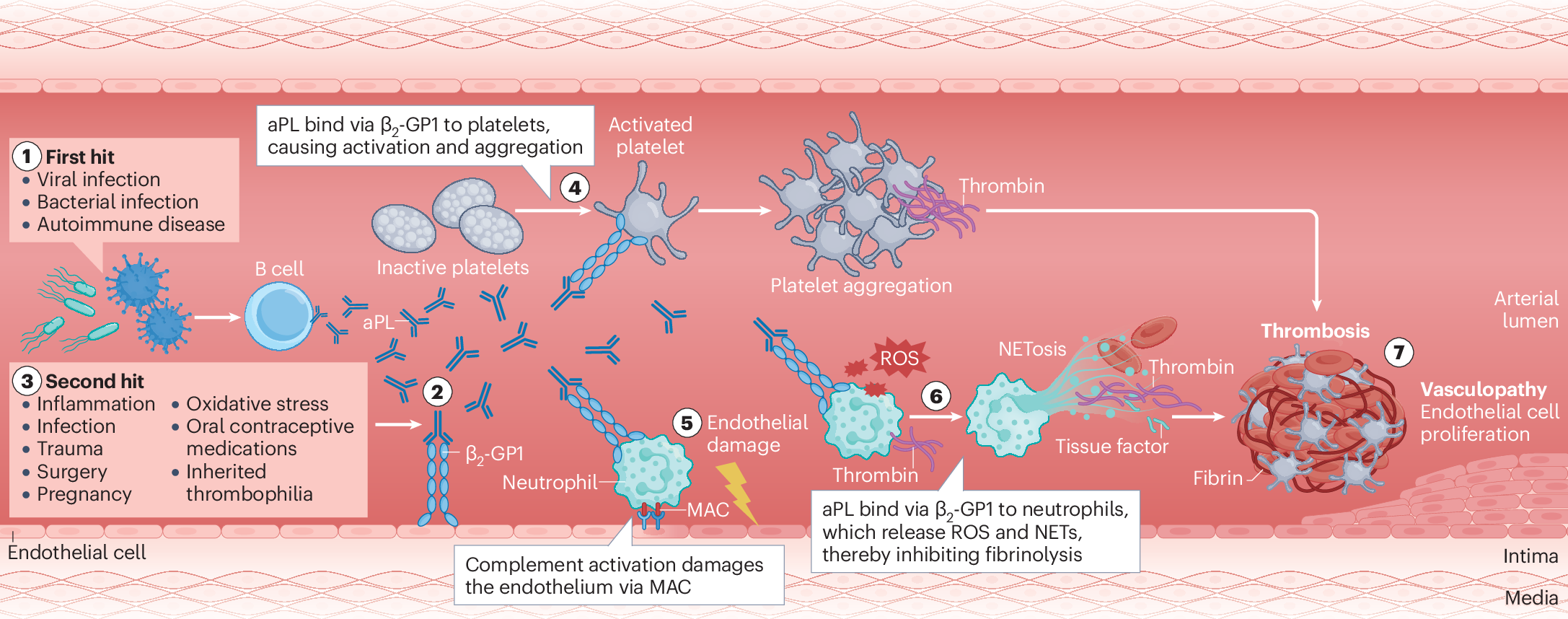 iv glutathione autoimmune dr k Can Therapy Help Diseases? Case 7-2025: A 65-Year-Old Woman
