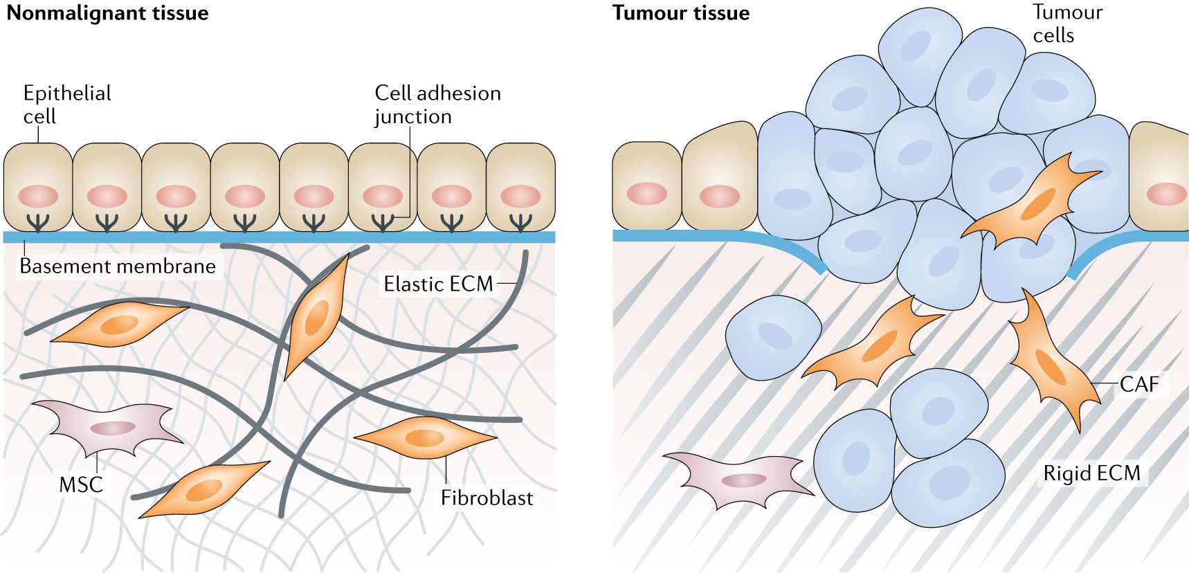 Targeting the tumour stroma to improve cancer therapy | Nature Reviews  Clinical Oncology
