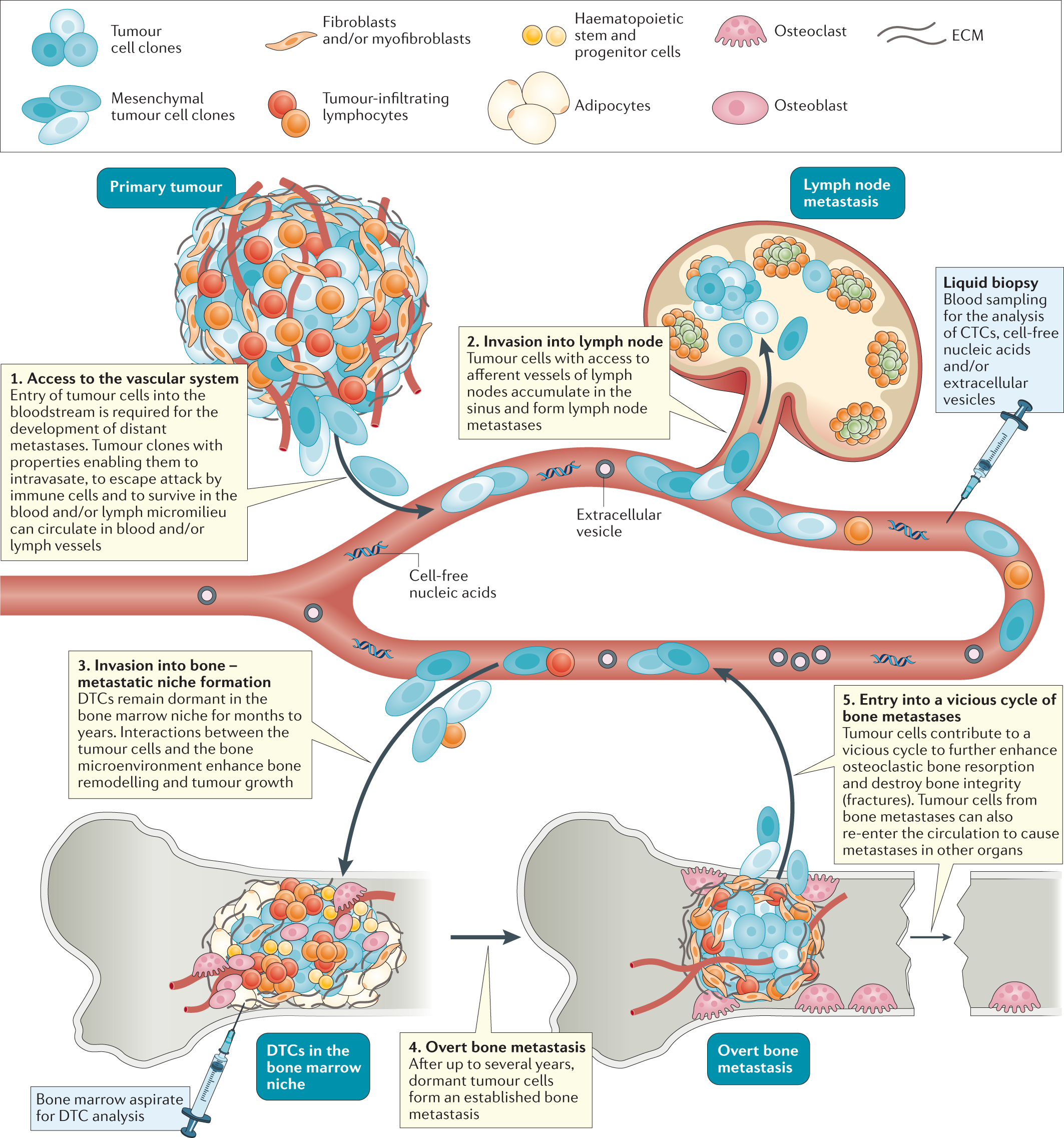 Novel approaches to target the microenvironment of bone metastasis | Nature  Reviews Clinical Oncology