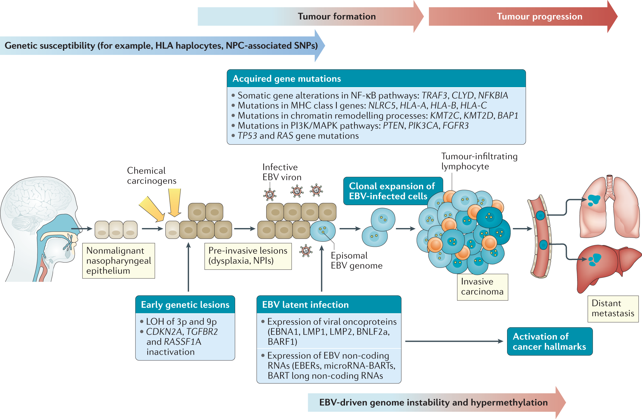 Nasopharyngeal carcinoma an evolving