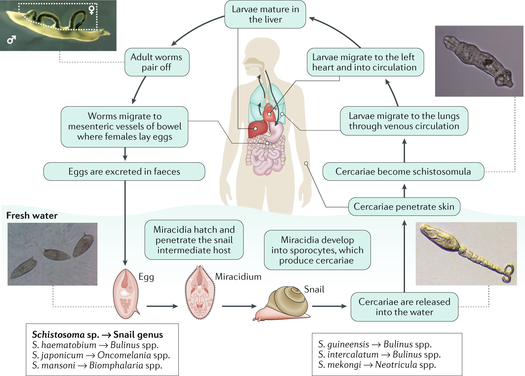 schistosomiasis anemia)