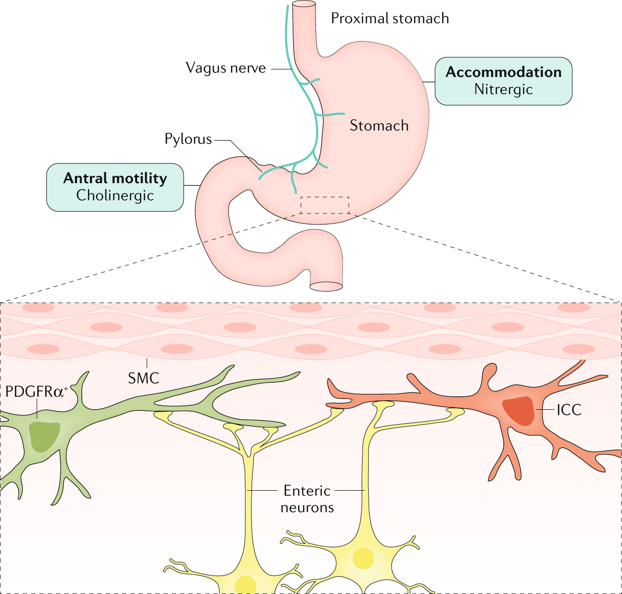 diabetic gastroparesis uptodate diabétesz kezelésére idős emberek