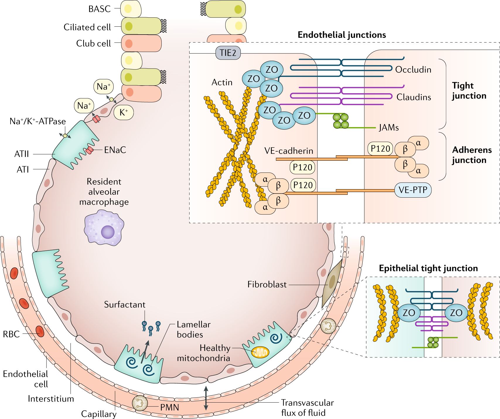 Acute Respiratory Distress Syndrome | Nature Reviews Disease Primers