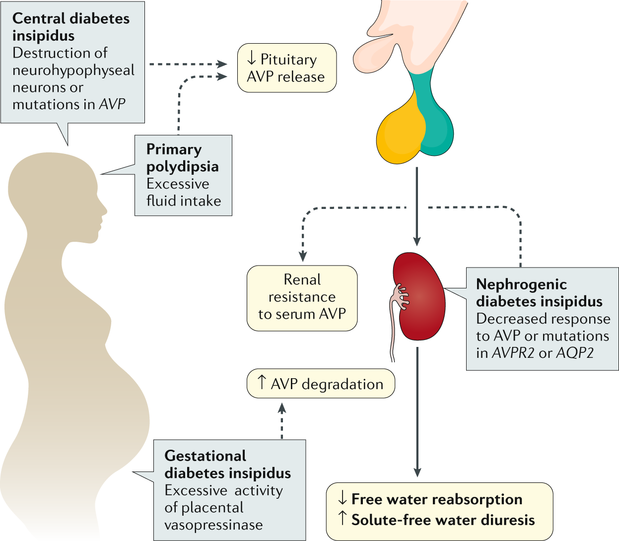 Progesztin diabetes insipidus