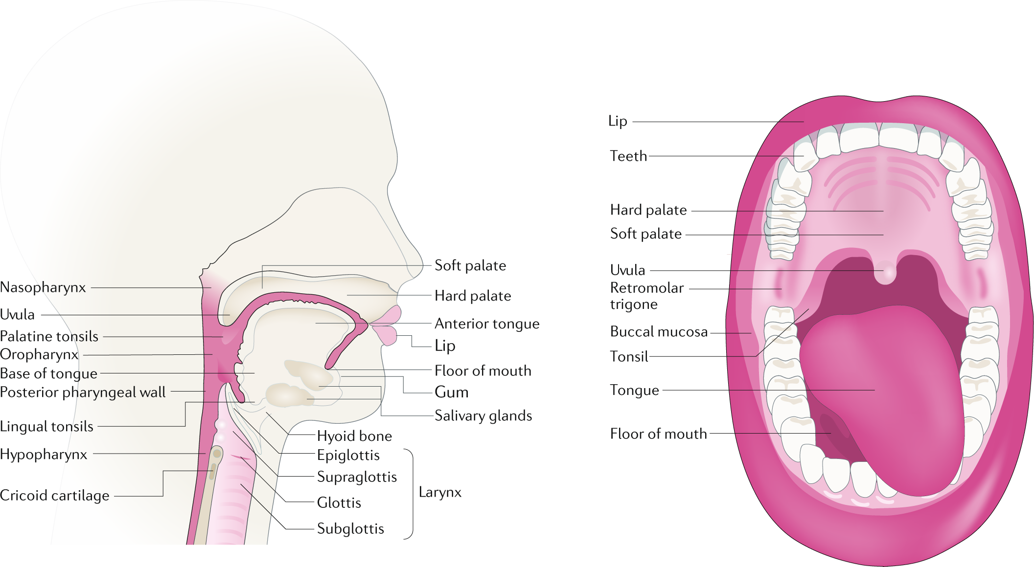 lingual tonsil cancer symptoms