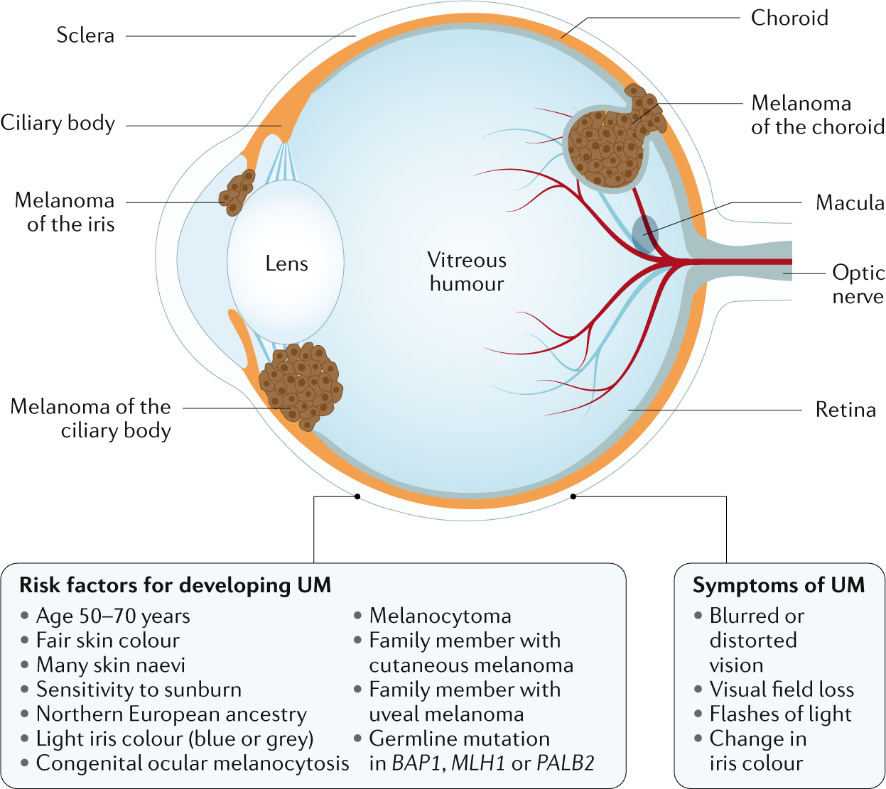 Uveal Melanoma Nature Reviews Disease Primers