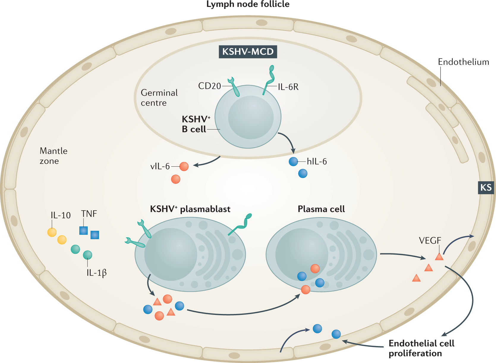 Full Hd Sex Video Belec - Castleman disease | Nature Reviews Disease Primers