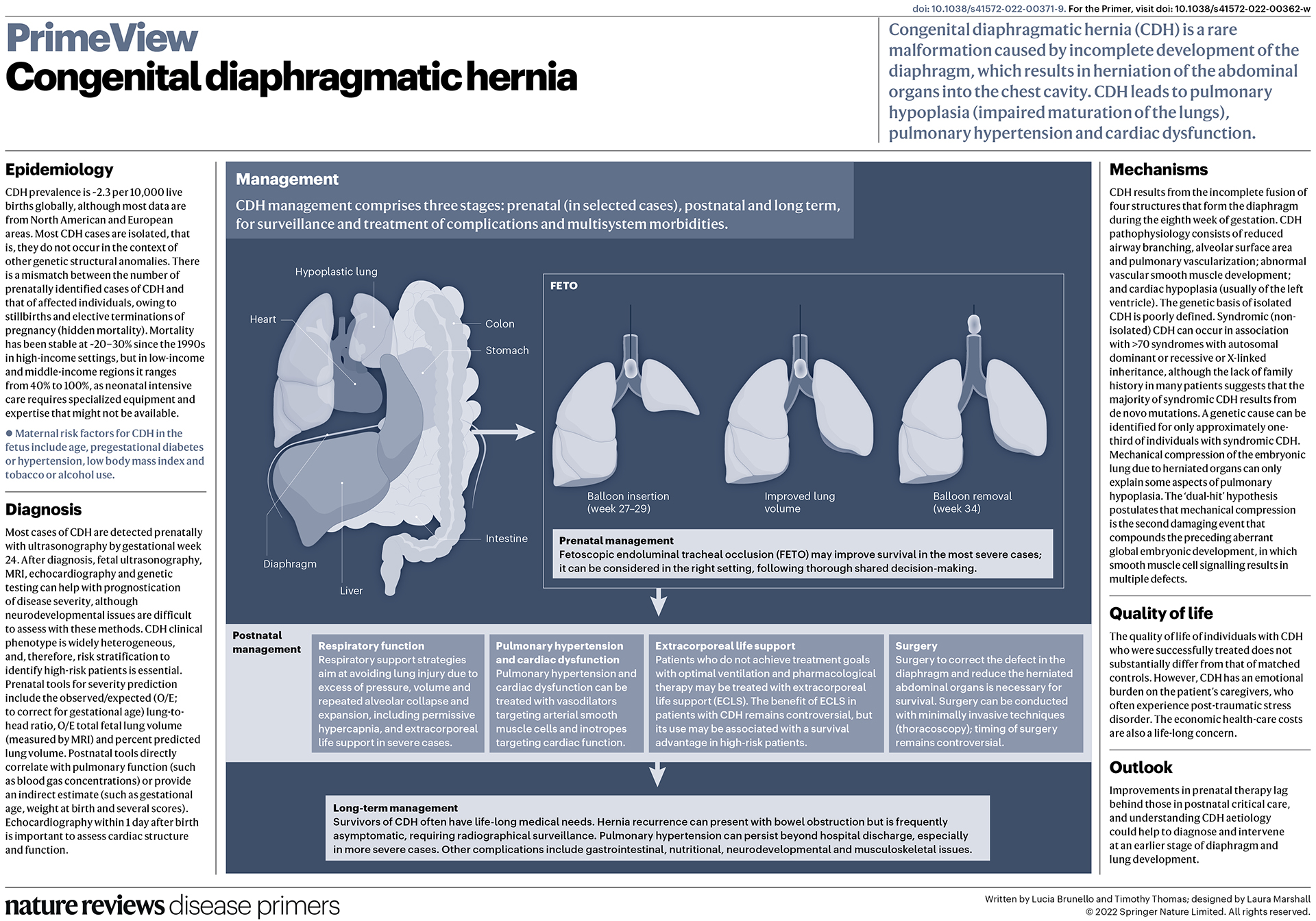 Congenital diaphragmatic hernia | Nature Reviews Disease Primers, image size:1920x1344