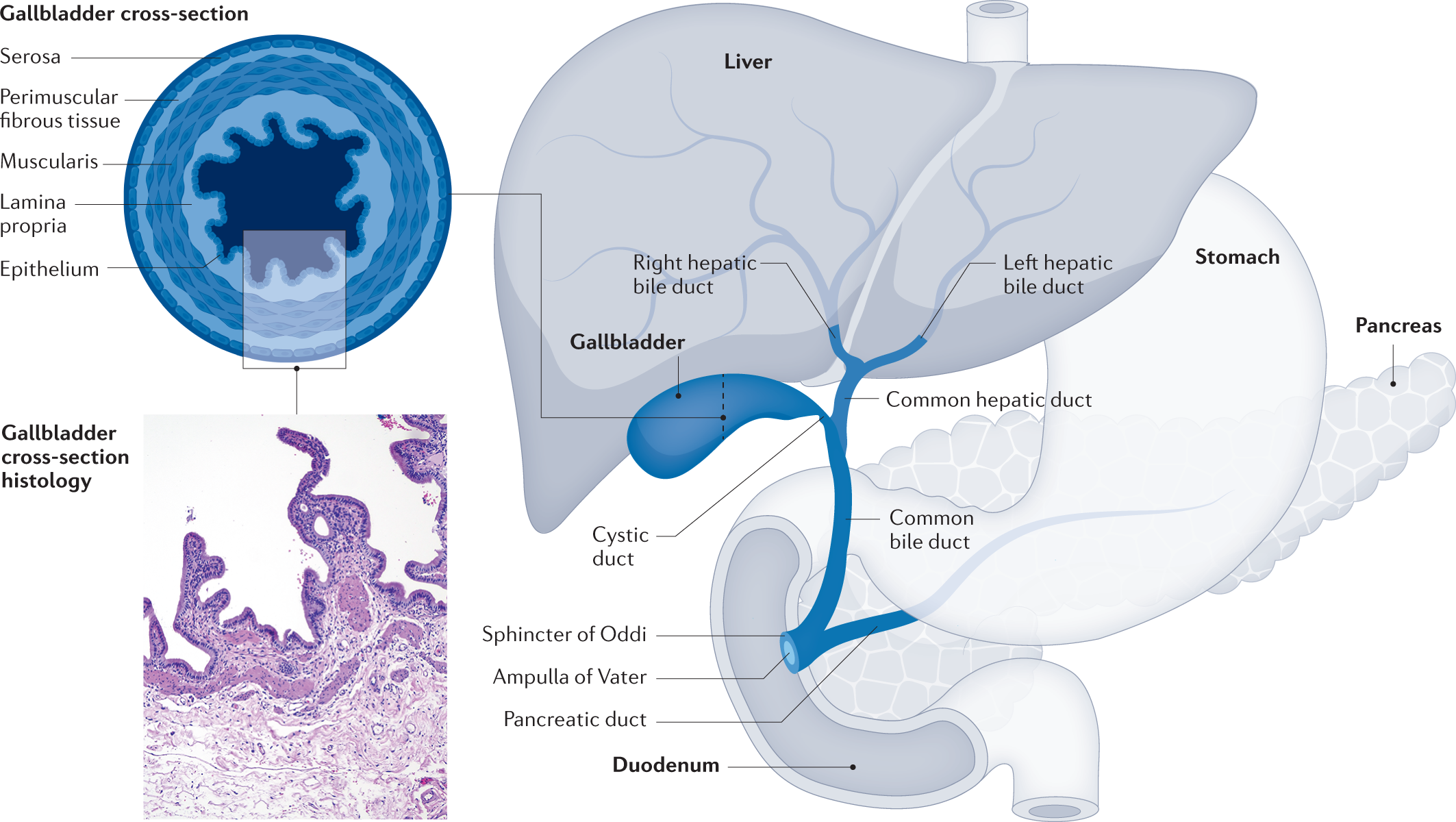 Gallbladder cancer  Nature Reviews Disease Primers