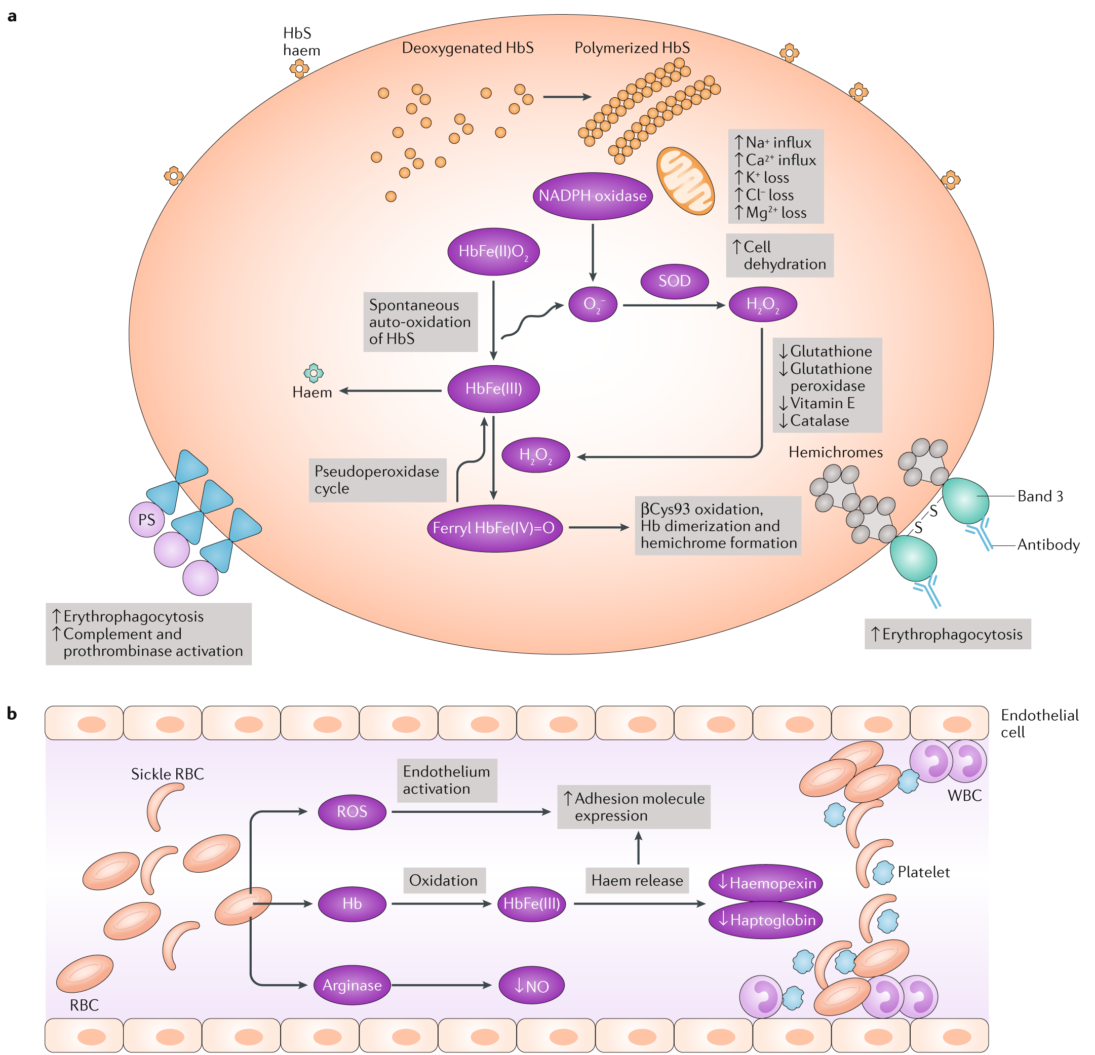 Therapeutic strategies for sickle cell disease: towards a multi-agent  approach | Nature Reviews Drug Discovery