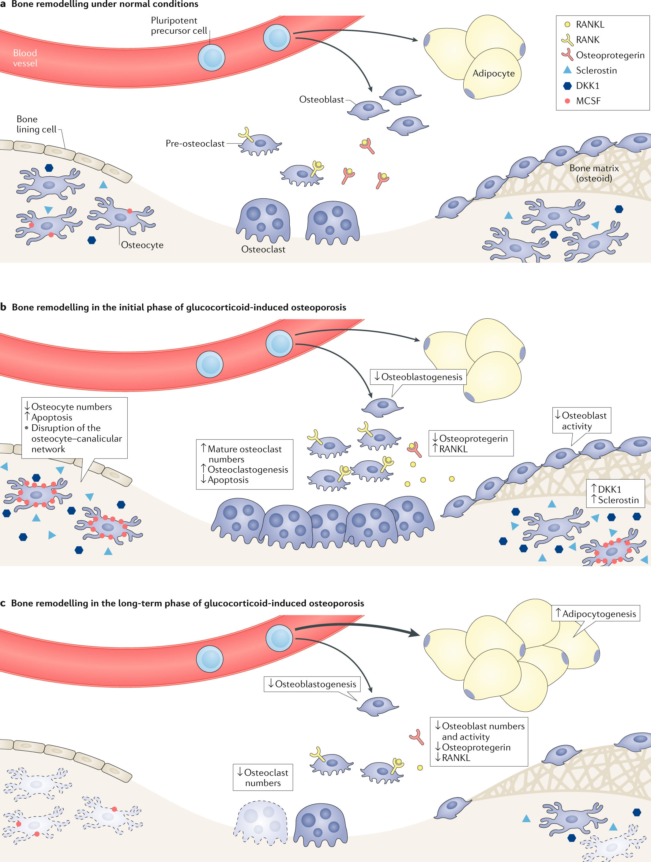 Pathogenesis of glucocorticoid-induced osteoporosis and options for  treatment | Nature Reviews Endocrinology