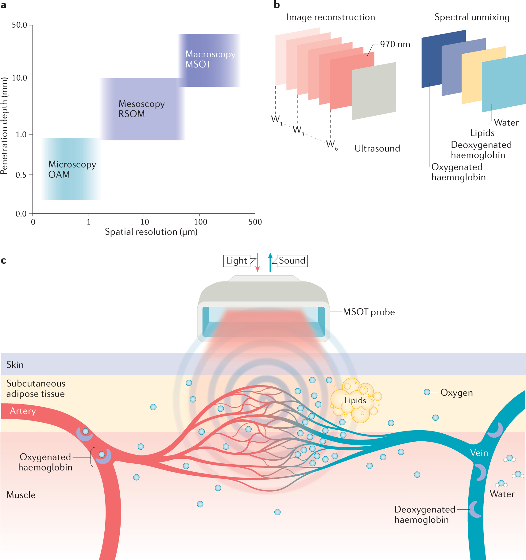 Optoacoustic imaging identifies breast cancer from vascular patterns –  Physics World