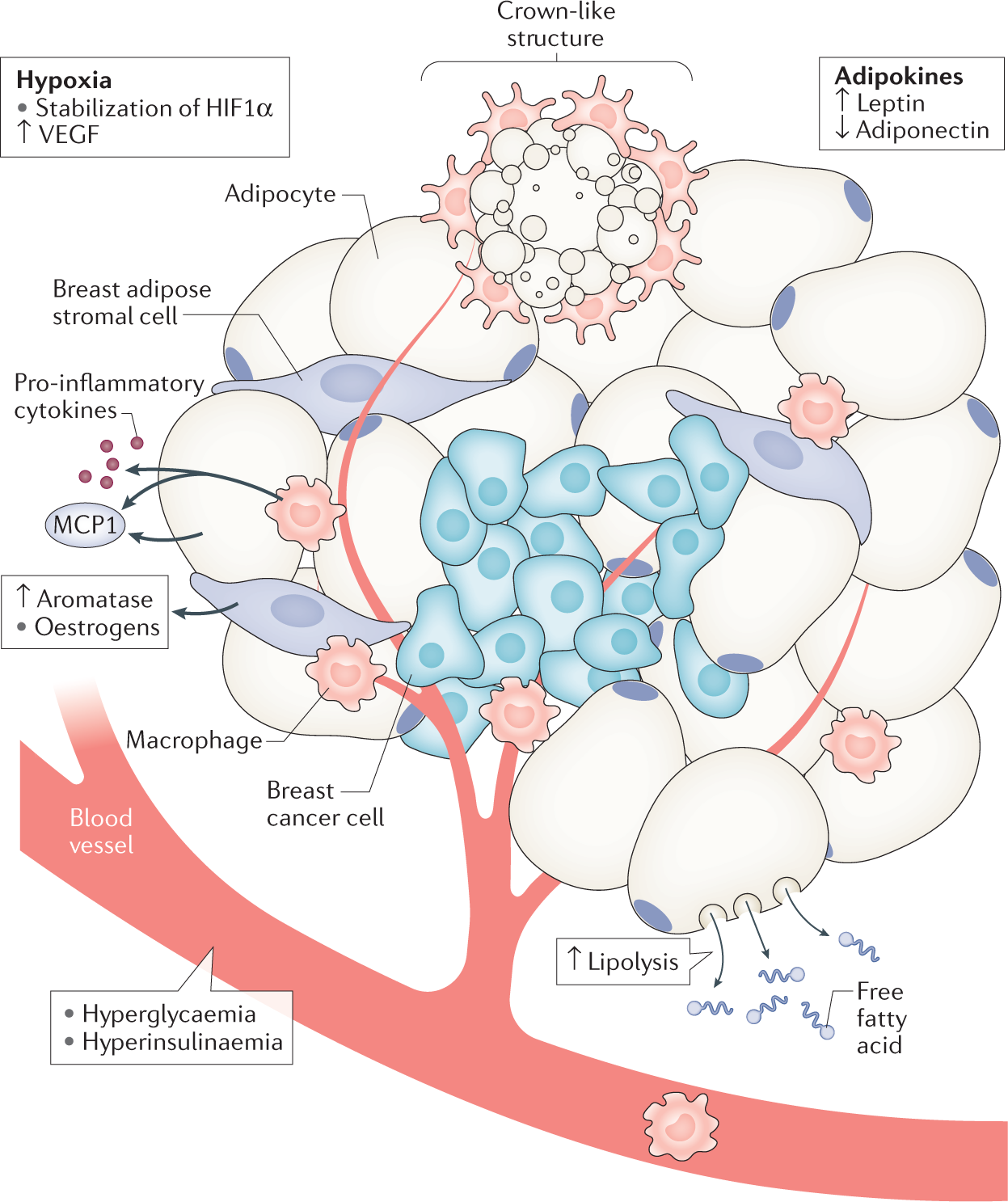 Metabolic pathways in obesity-related breast cancer | Nature Reviews  Endocrinology
