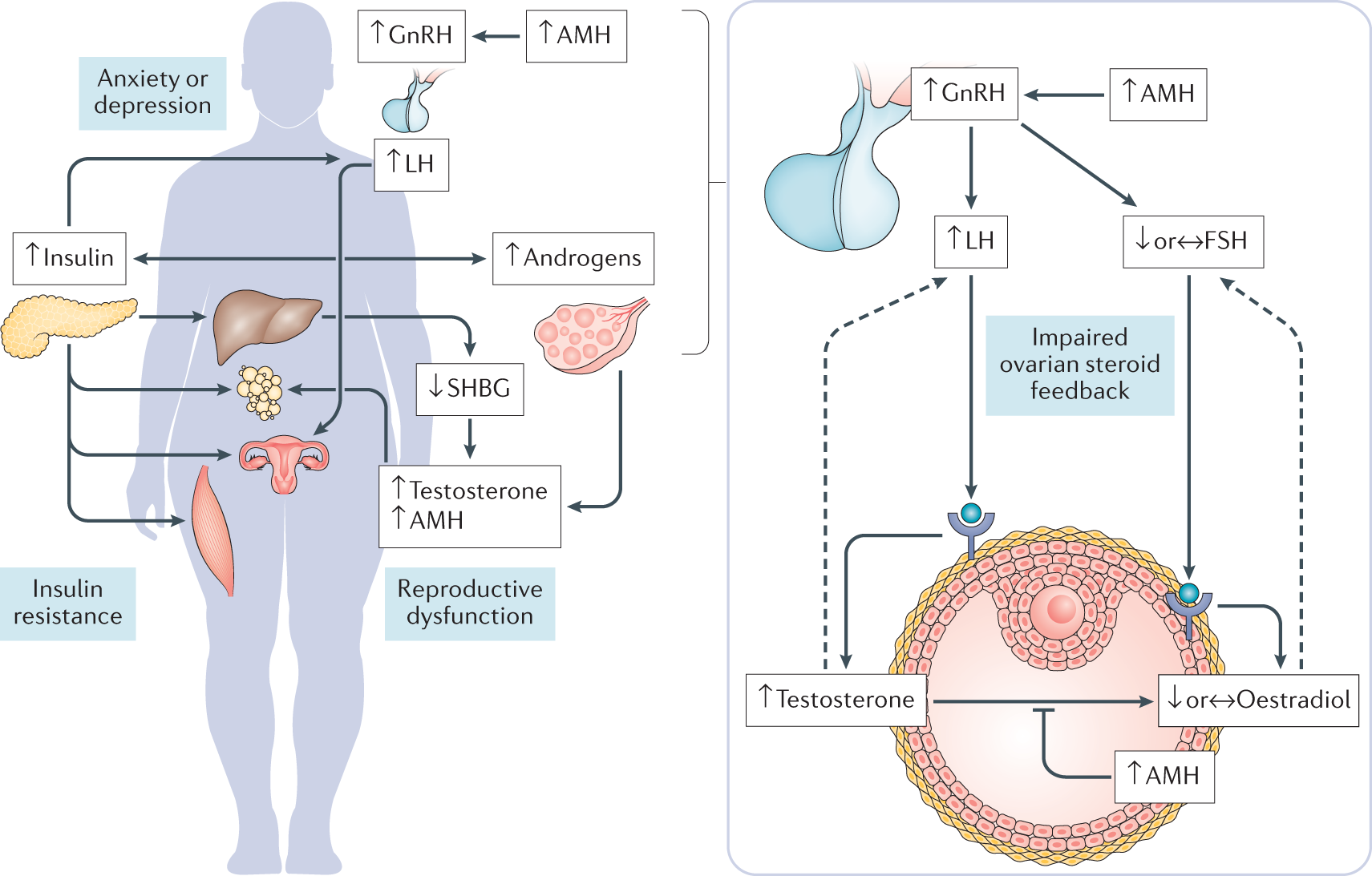 Epigenetic Inheritance Of Polycystic Ovary Syndrome Challenges And Opportunities For Treatment Nature Reviews Endocrinology