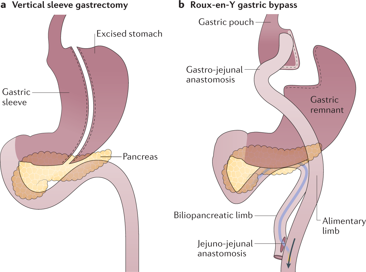 Morals Key Inquiry In Bariatric Medical process