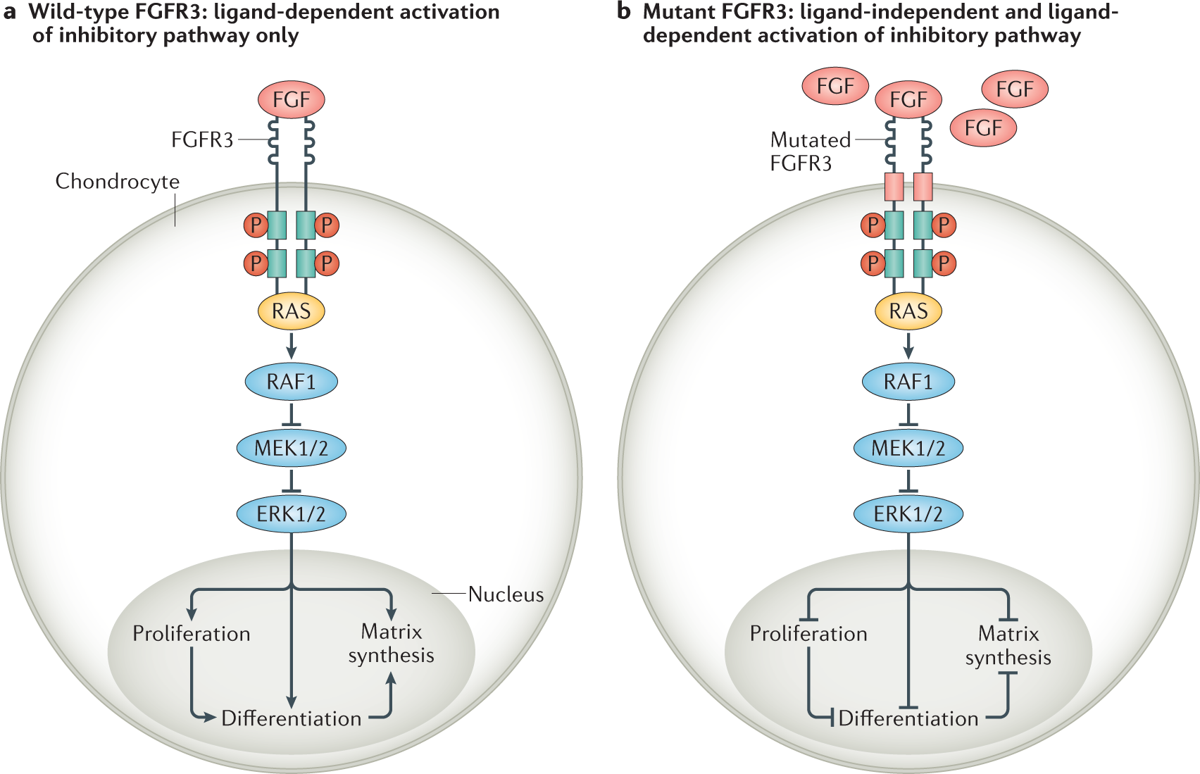 International Consensus Statement on the diagnosis, multidisciplinary  management and lifelong care of individuals with achondroplasia | Nature  Reviews Endocrinology