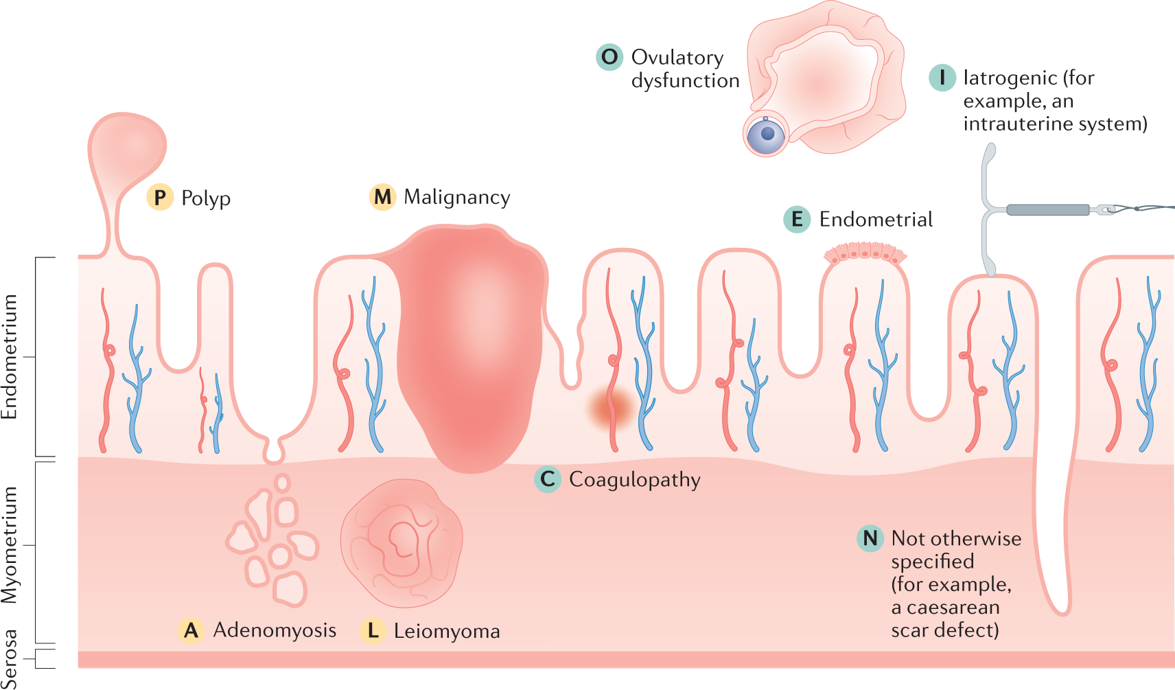 Uterine bleeding how understanding endometrial physiology underpins menstrual health Nature Reviews Endocrinology