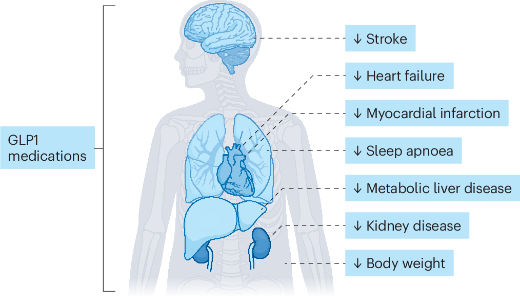 glp-1 gastric intestinal obstruction lawyer in kentucky Mounjaro and Ozempic Stomach Paralysis Lawyer