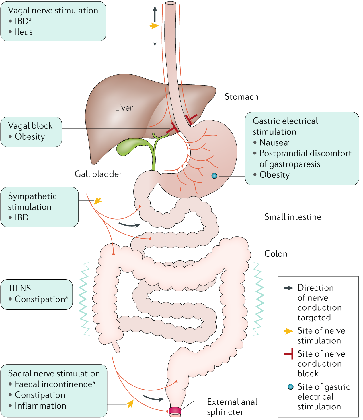 TENS Placement for Constipation: Instructions and FAQs