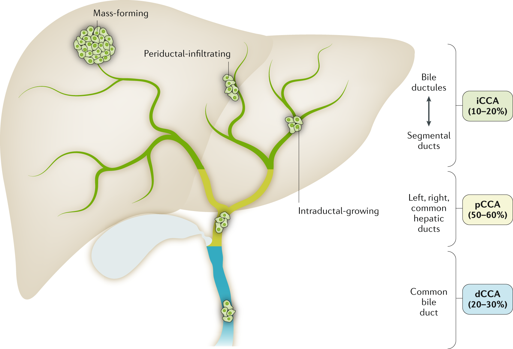 Cholangiocarcinoma 2020: the next horizon in mechanisms and management |  Nature Reviews Gastroenterology & Hepatology