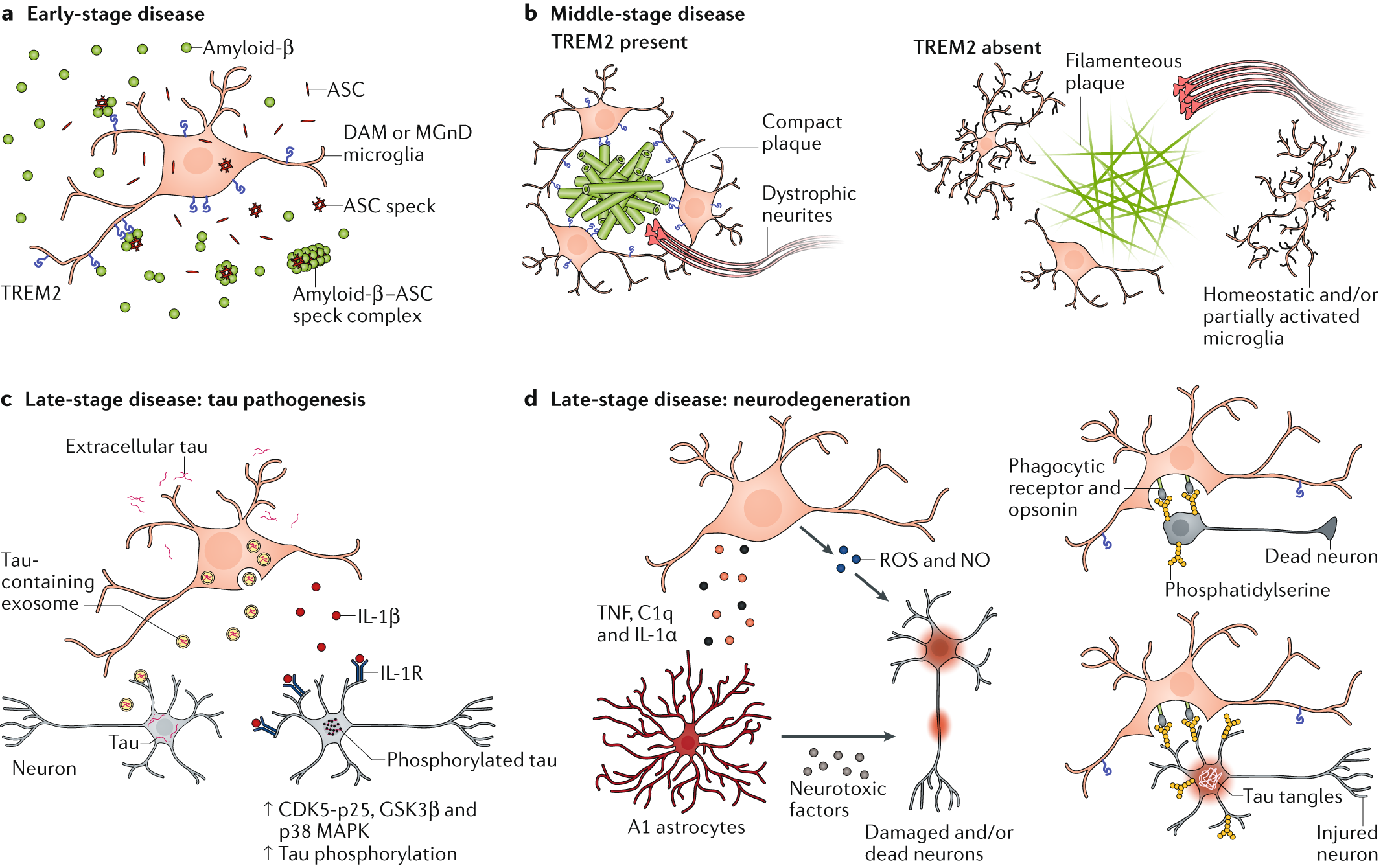 Болезнь альцгеймера презентация патофизиология