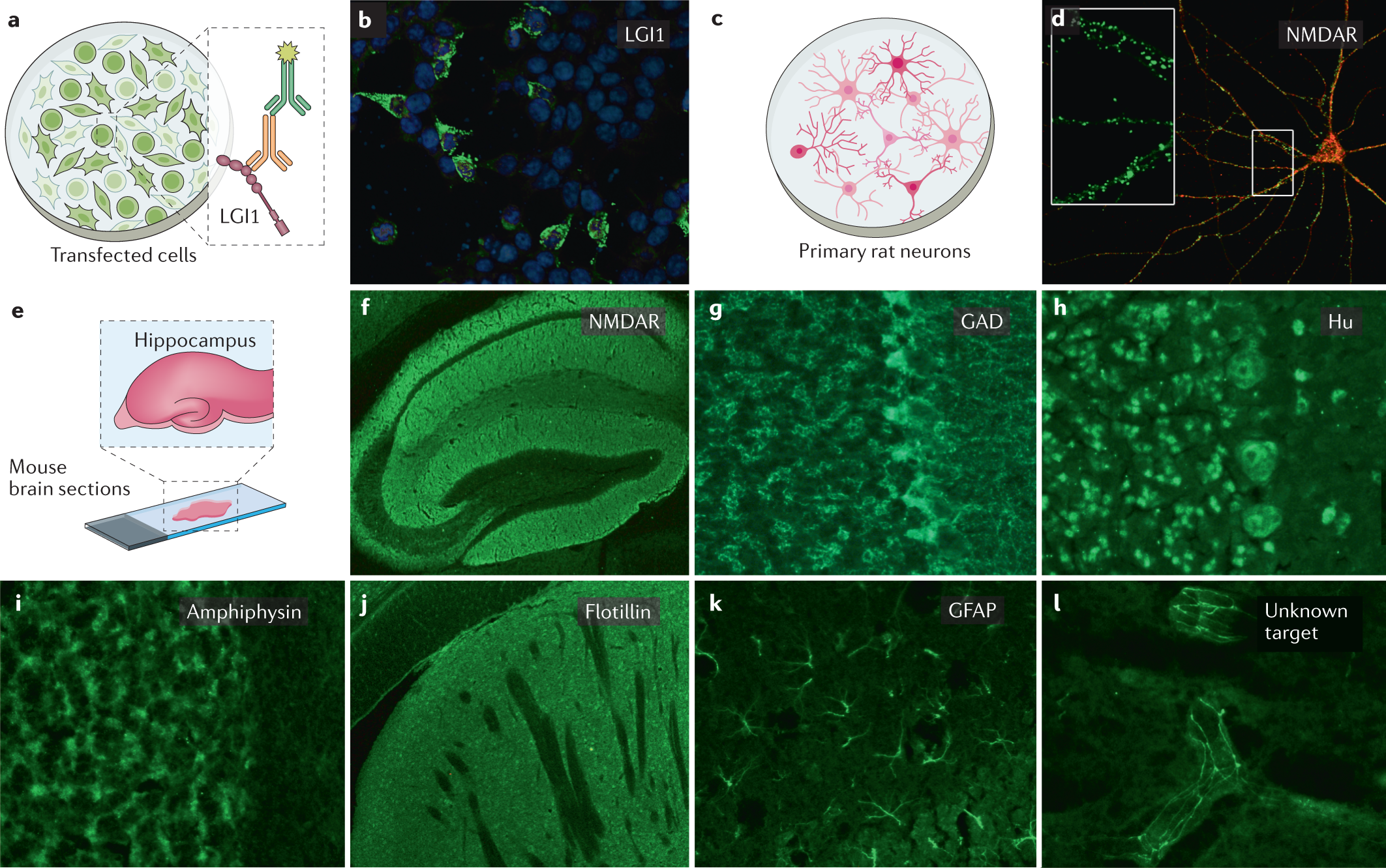 Autoantibodies In Neurological Disease Nature Reviews Immunology