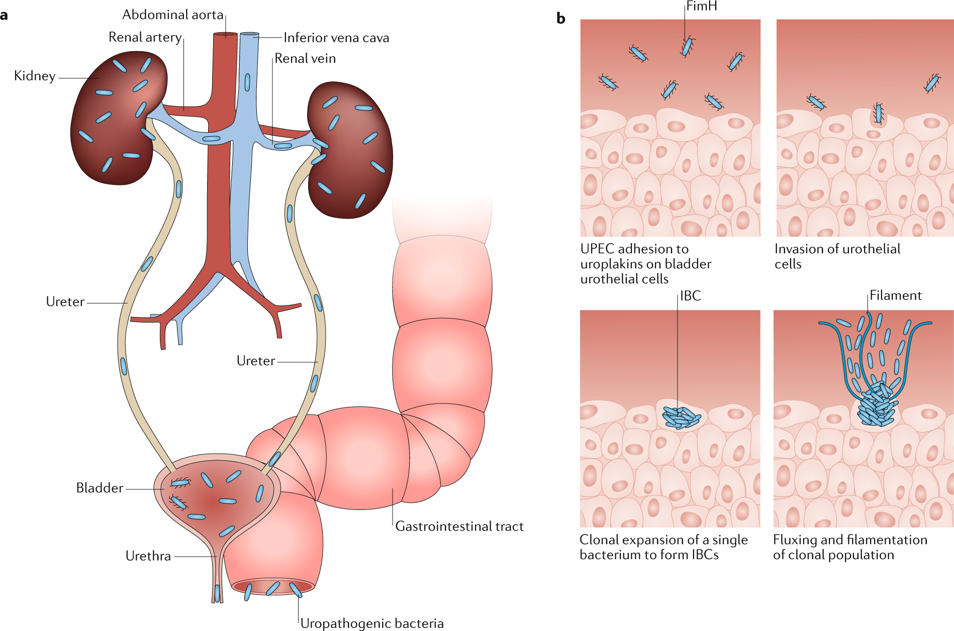 Urinary tract infections: microbial pathogenesis, host–pathogen  interactions and new treatment strategies | Nature Reviews Microbiology