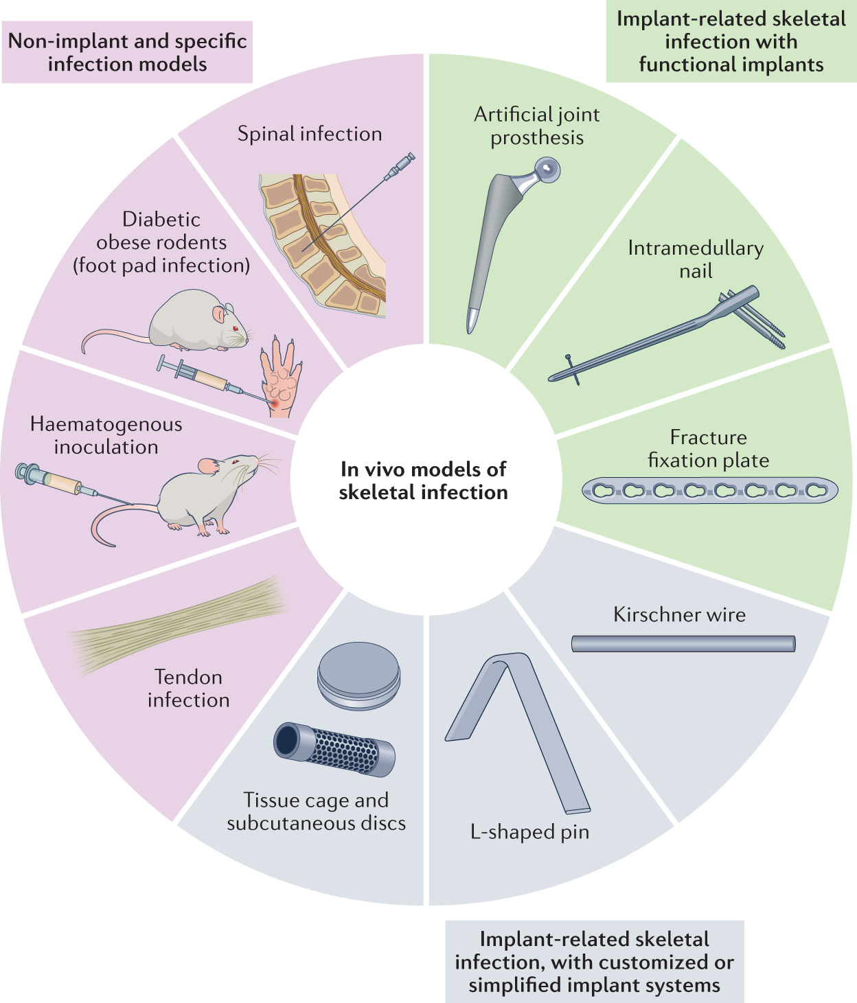 Skeletal infections: microbial pathogenesis, immunity and clinical  management | Nature Reviews Microbiology