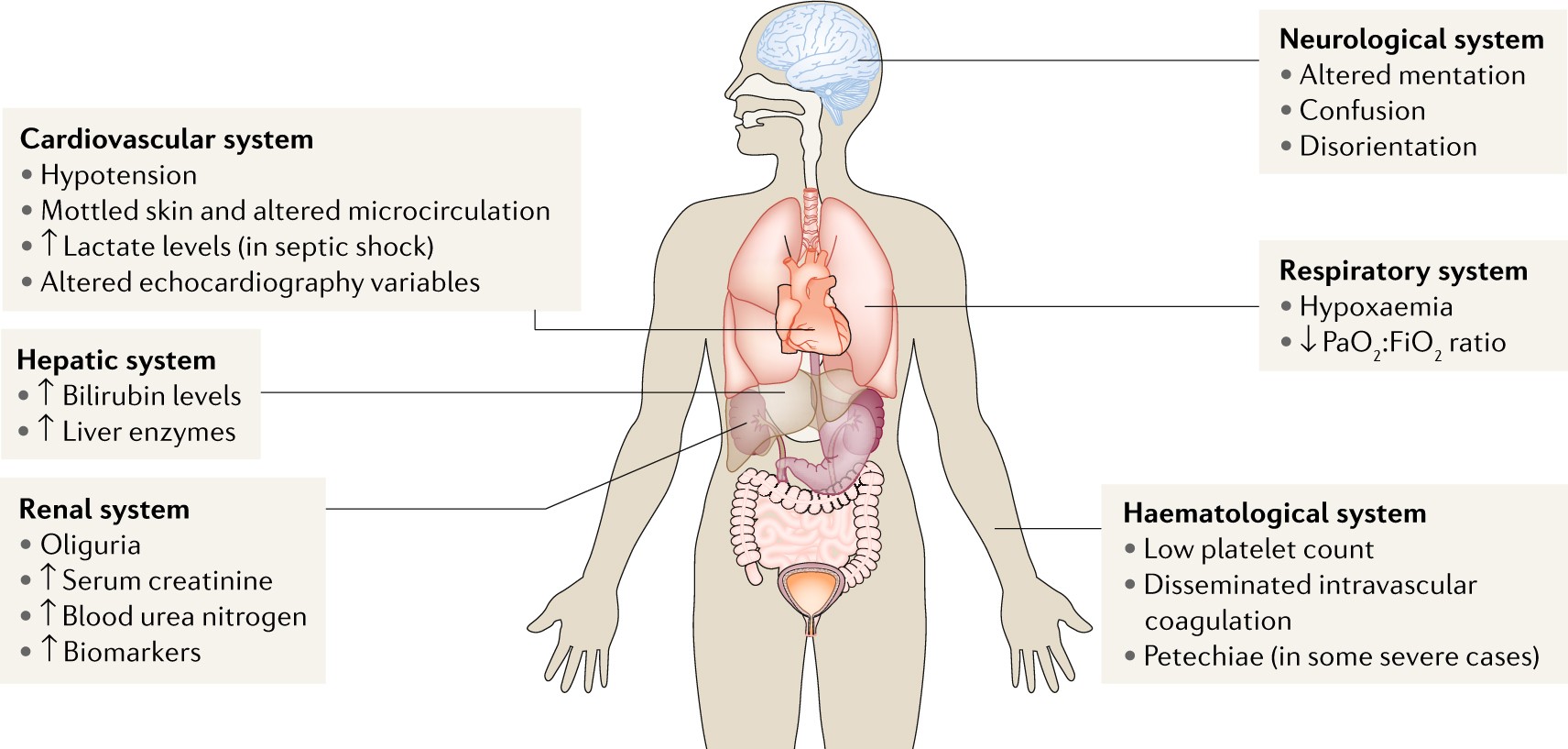 Mechanisms and treatment of organ failure in sepsis | Nature Reviews  Nephrology