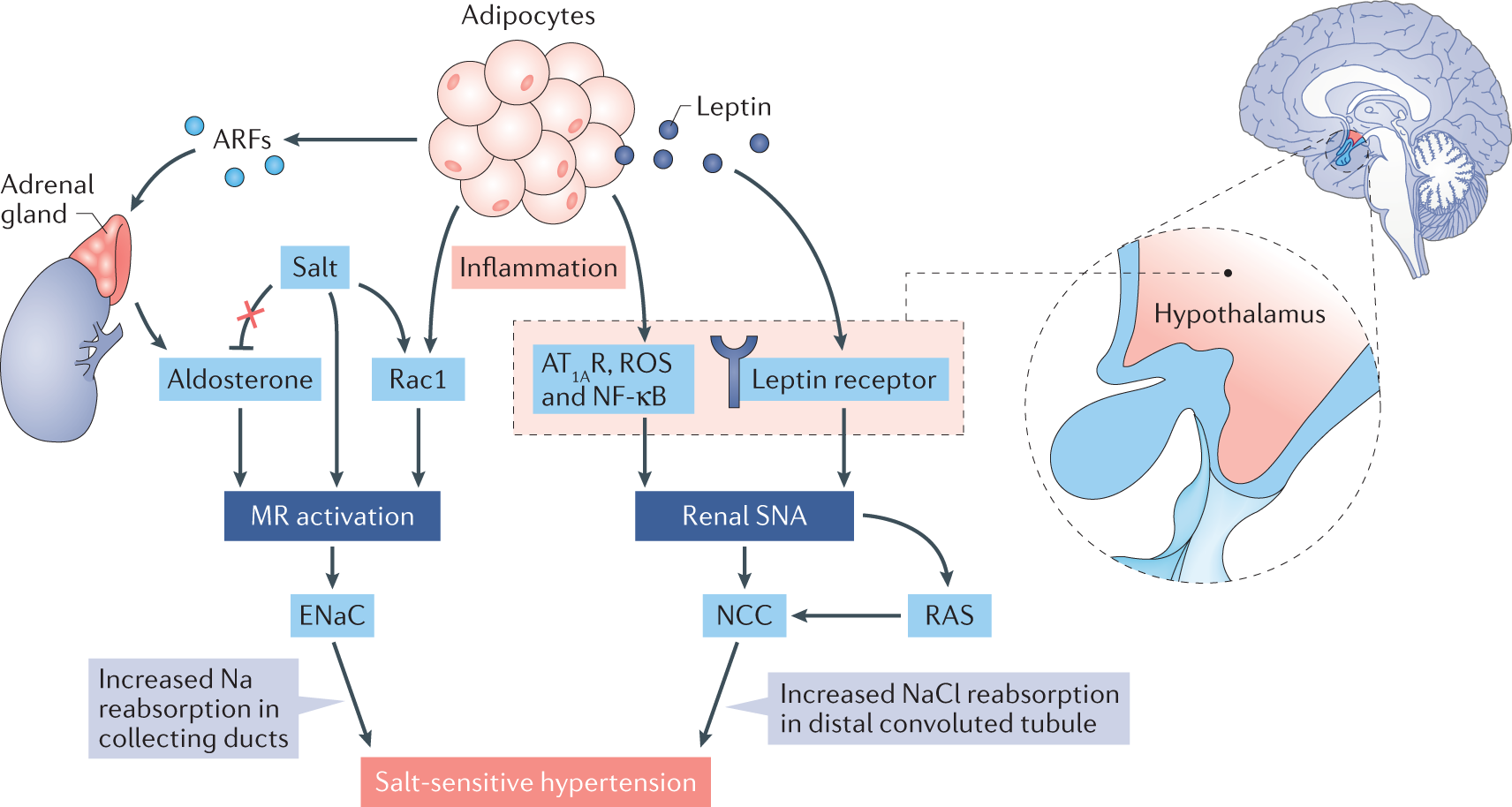 High Dietary Protein Exacerbates Hypertension and Renal Damage in Dahl SS Rats by Increasing Infiltrating Immune Cells in the Kidney
