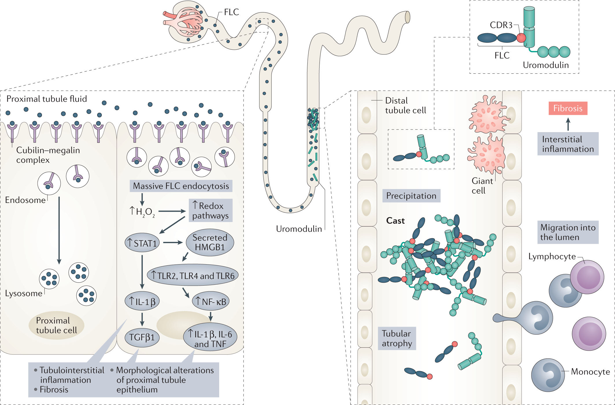 Kidney injury and disease in patients with haematological malignancies |  Nature Reviews Nephrology