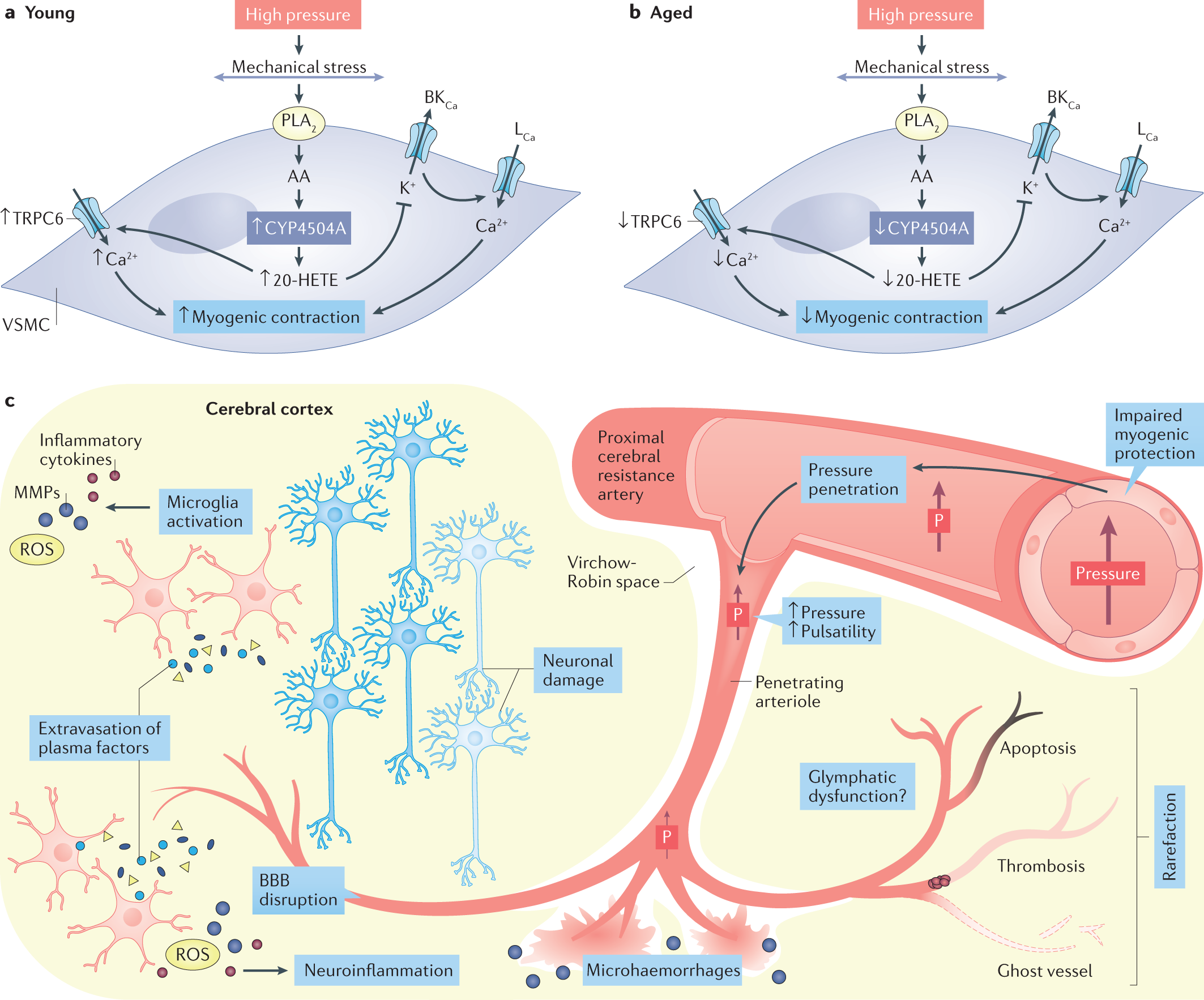 Hypertension-induced cognitive impairment: from pathophysiology to public  health | Nature Reviews Nephrology