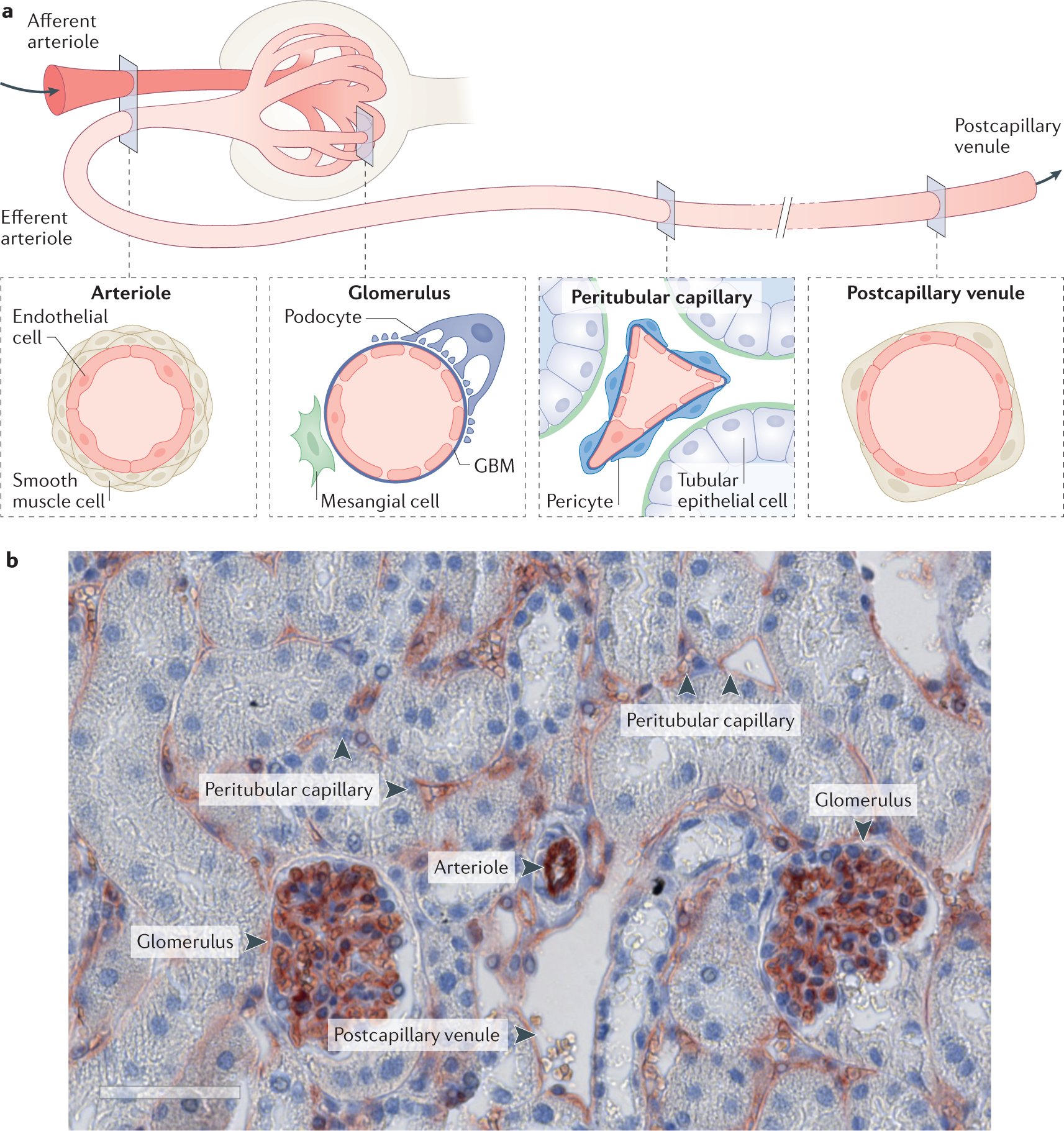 Renal microvascular endothelial cell responses in sepsis-induced acute  kidney injury | Nature Reviews Nephrology