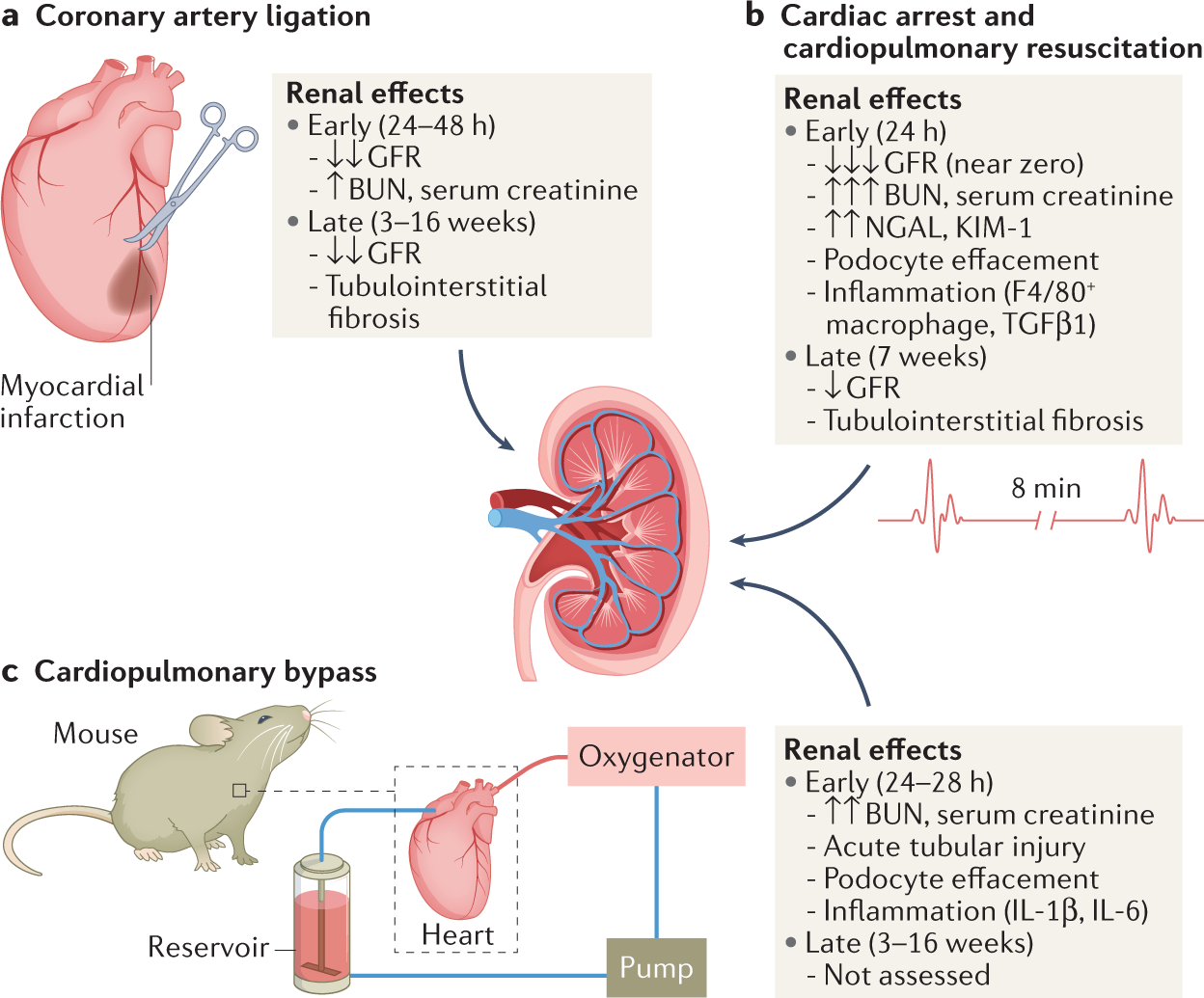 Experimental models of acute kidney injury for translational research |  Nature Reviews Nephrology