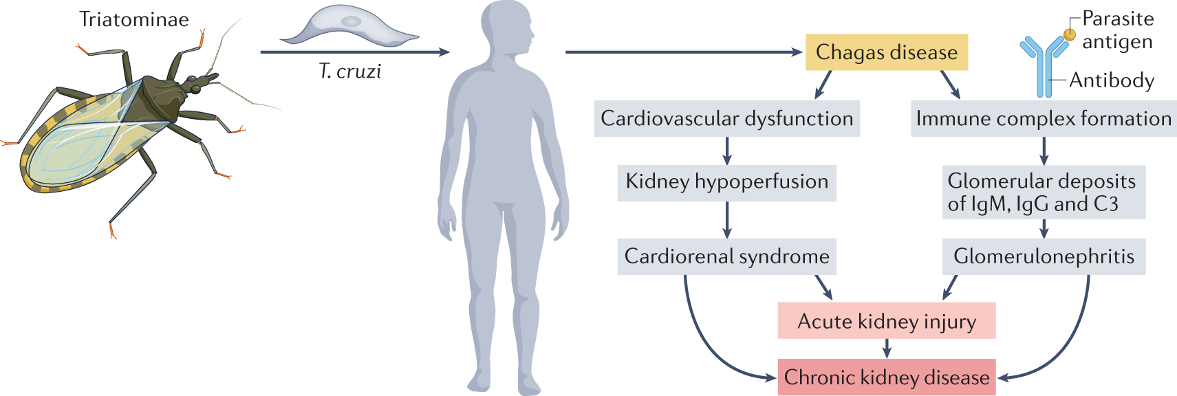 Kidney complications of parasitic diseases | Nature Reviews Nephrology Kidney complications of parasitic diseases | Nature Reviews Nephrology