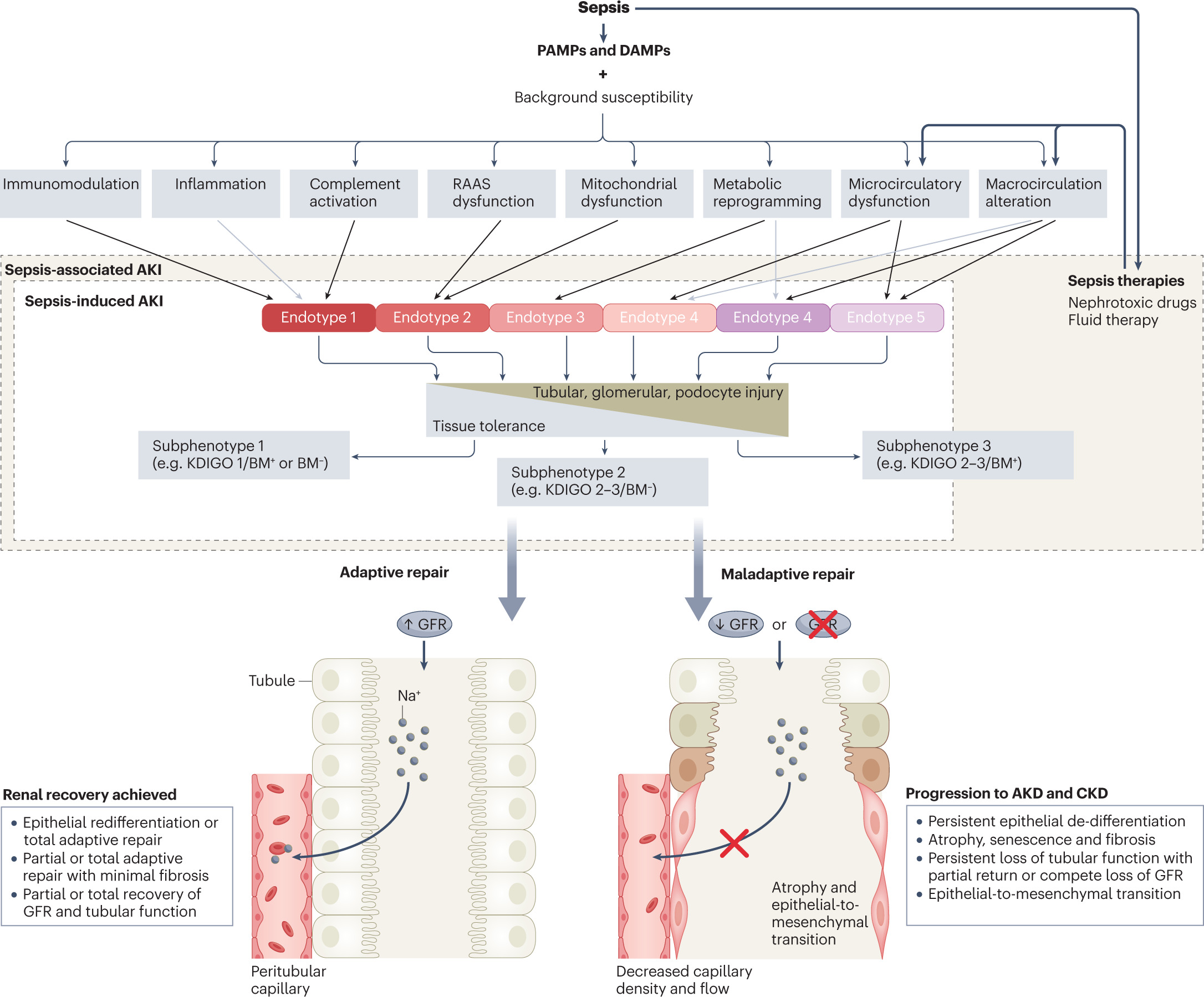 Sepsis-associated acute kidney injury: consensus report of the