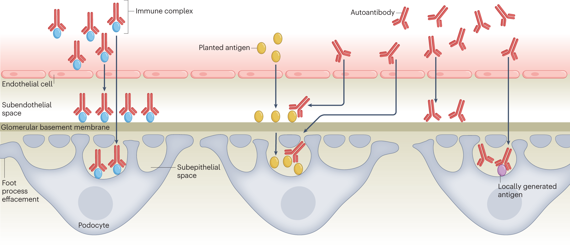 Pathogenesis of autoimmune disease