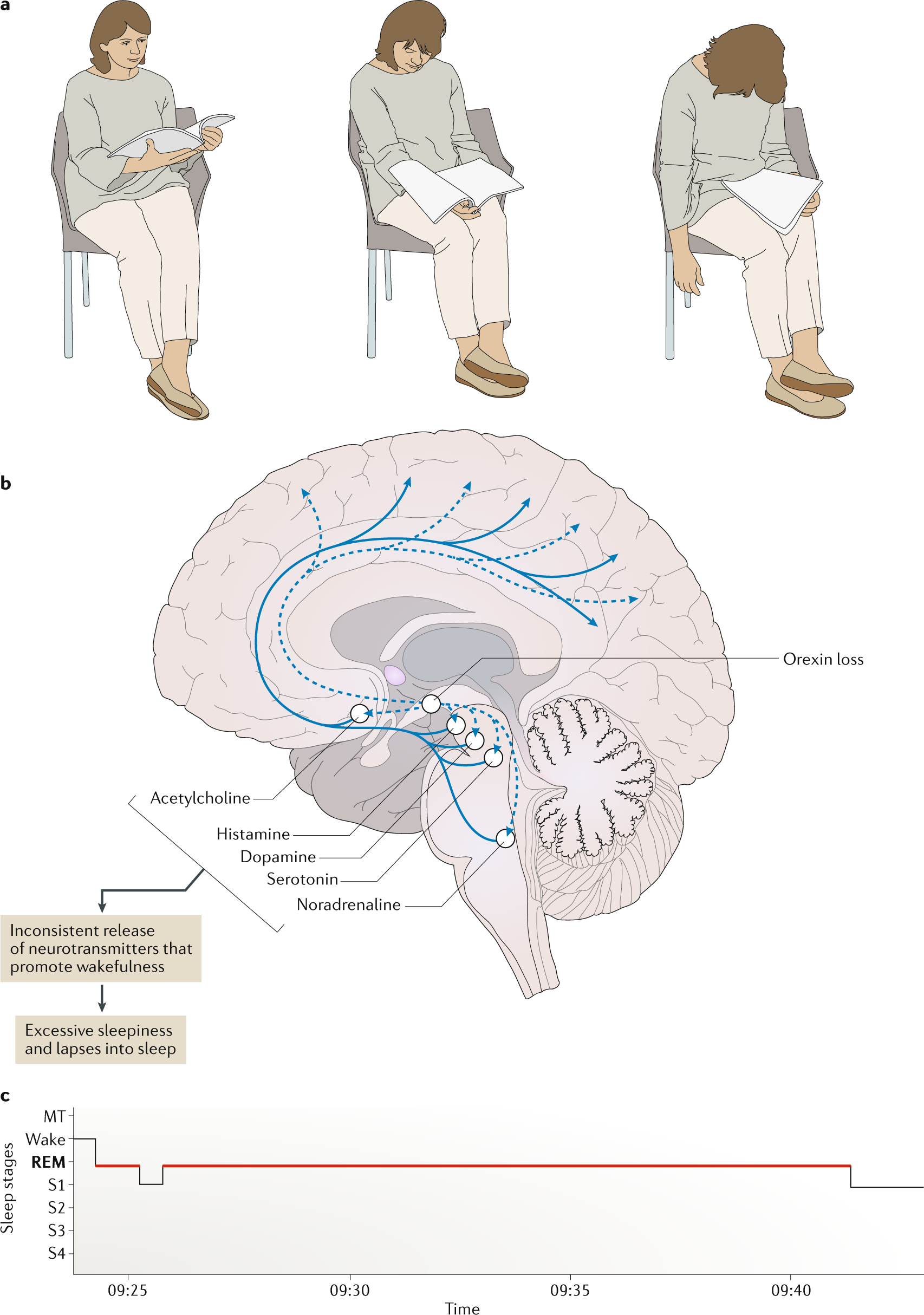 Napping in your car safely - if you have idiopathic hypersomnia or  narcolepsy type 1 or 2 - Hypersomnia Foundation