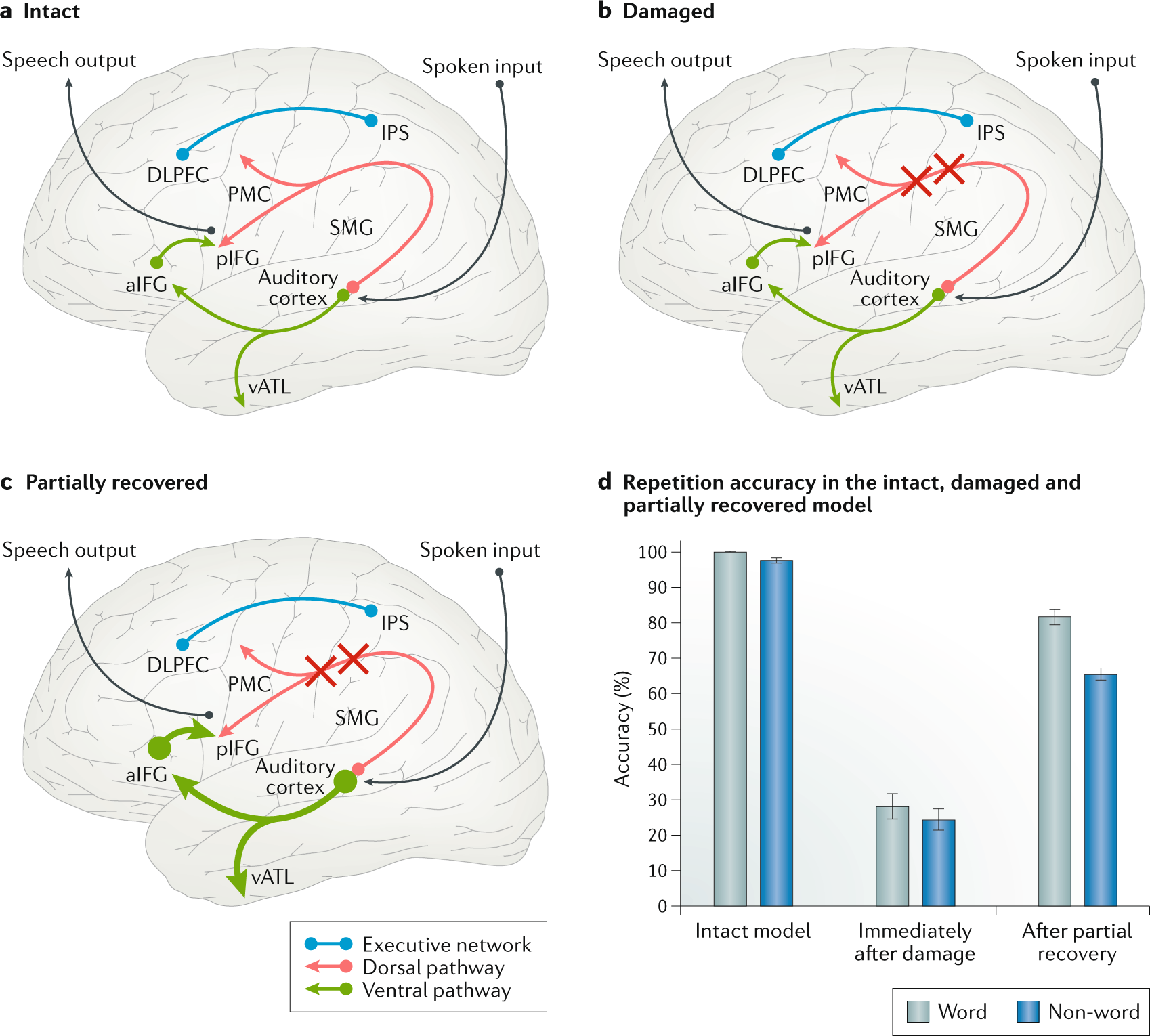 Pronoun processing in post-stroke aphasia: A meta-analytic review of  individual data - ScienceDirect