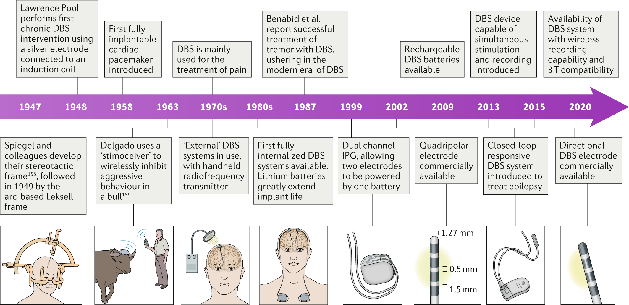 Technology of deep brain stimulation: current status and future directions  | Nature Reviews Neurology