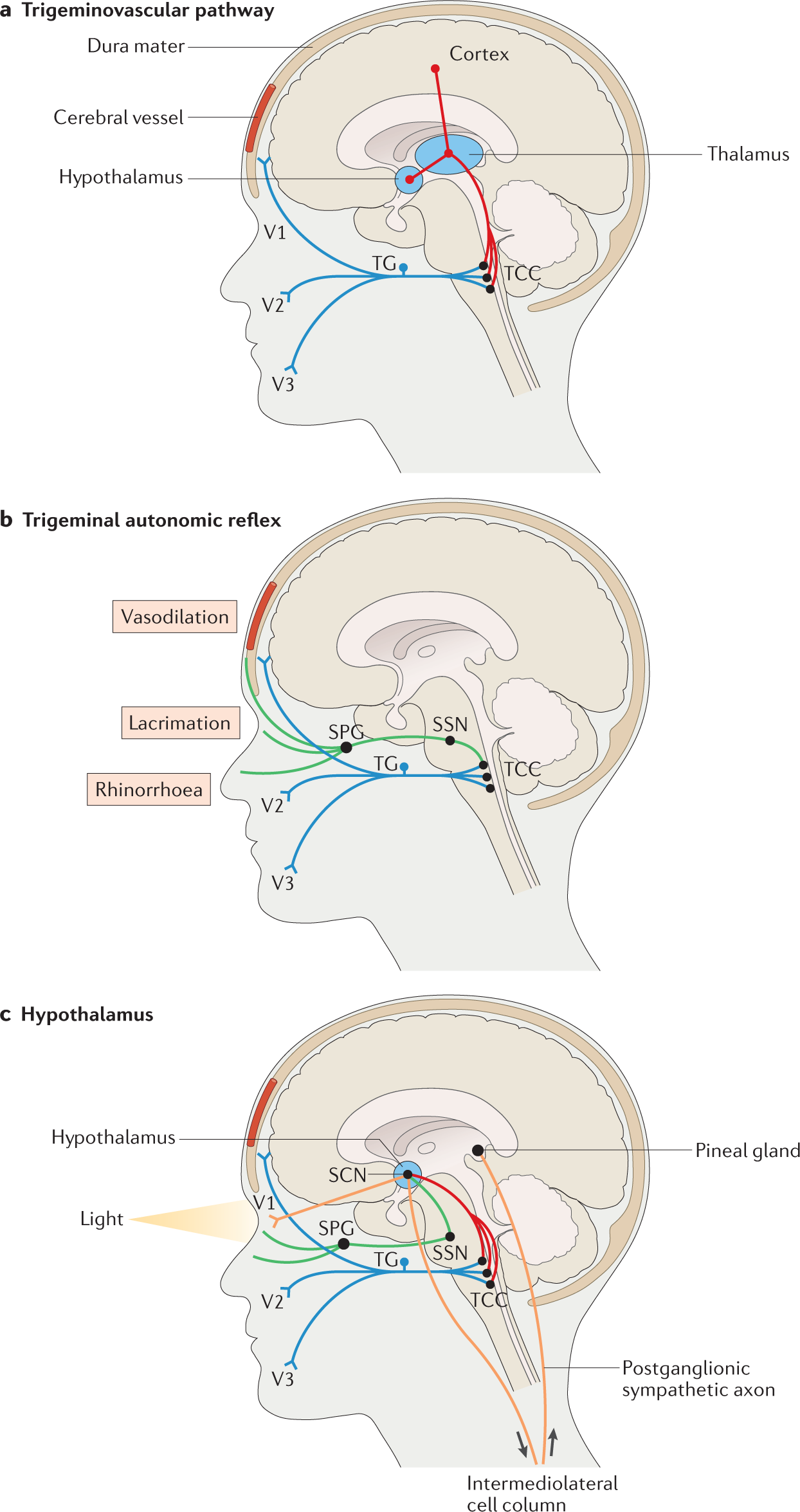 Cluster headache pathophysiology — insights from current and emerging  treatments | Nature Reviews Neurology