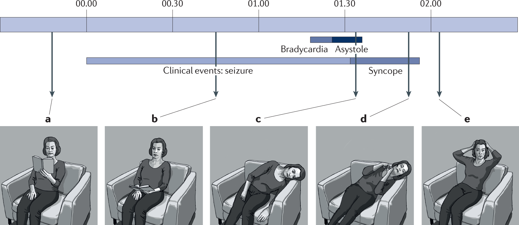 Seizure Detection and SUDEP Prevention - Practical Neurology