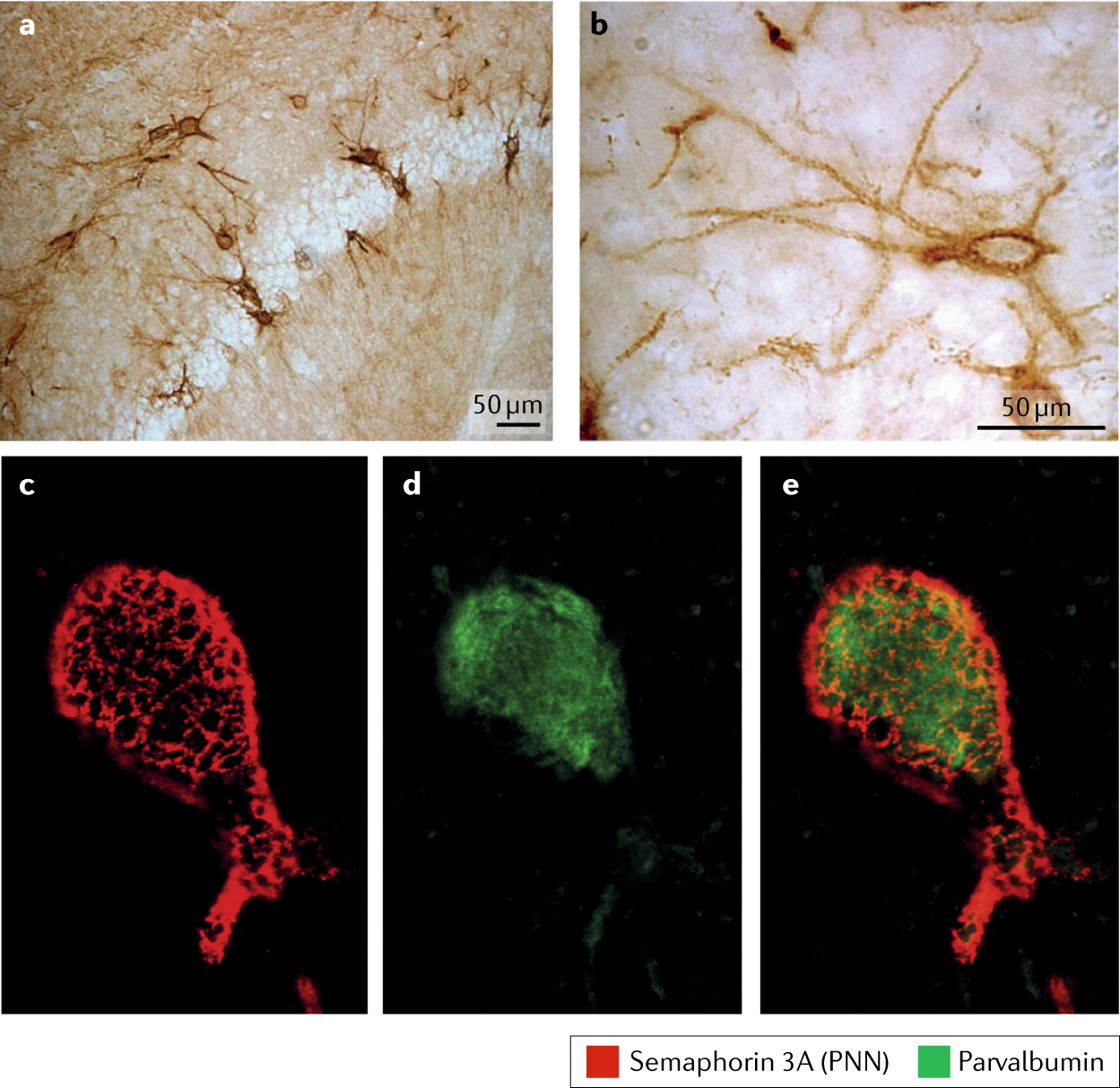 The Roles Of Perineuronal Nets And The Perinodal Extracellular Matrix In Neuronal Function Nature Reviews Neuroscience The Roles Of Perineuronal Nets And The Perinodal Extracellular Matrix In Neuronal Function Nature Reviews Neuroscience