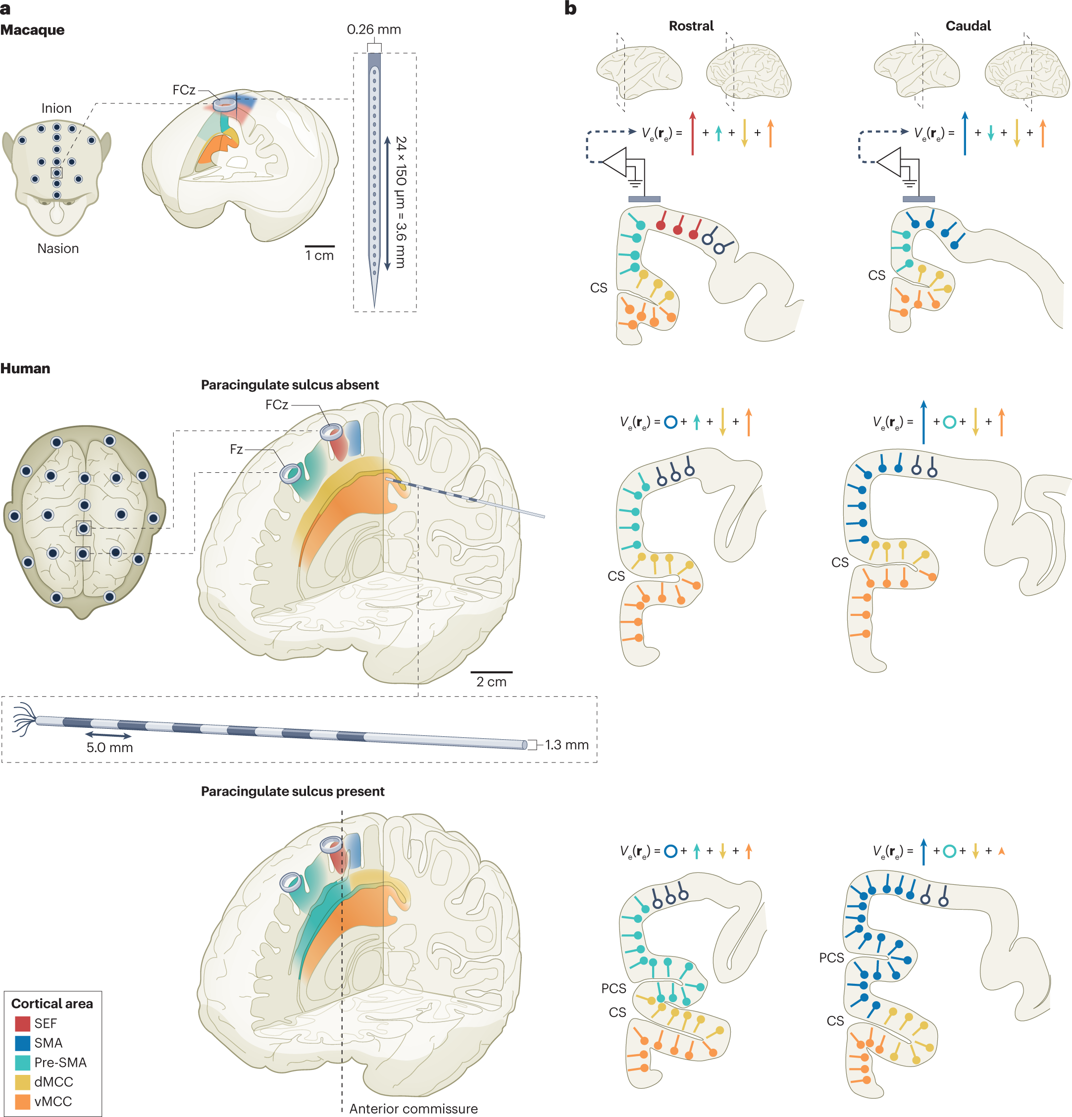 https://media.springernature.com/full/springer-static/image/art%3A10.1038%2Fs41583-022-00670-w/MediaObjects/41583_2022_670_Fig1_HTML.png